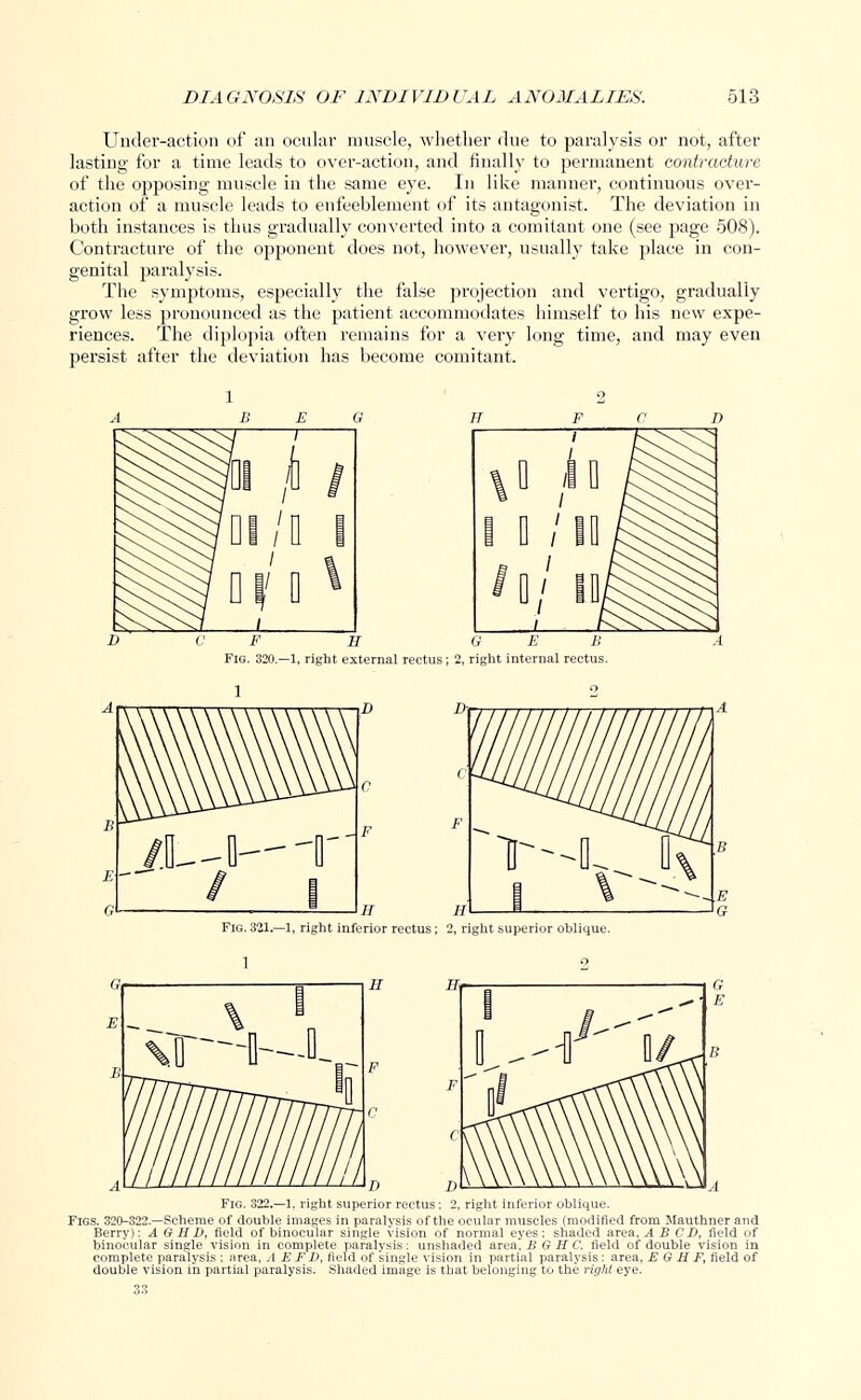 Under-action of an ocular muscle, whether due to paralysis or not, after lasting for a time leads to over-action, and finally to permanent contracture of the opposing muscle in the same eye. In like manner, continuous over- action of a muscle leads to enfeeblement of its antagonist. The deviation in both instances is thus gradually converted into a comitant one (see page 508). Contracture of the opponent does not, however, usually take place in con- genital paralysis. The symptoms, especially the false projection and vertigo, gradually grow less pronounced as the patient accommodates himself to his new expe- riences. The diplopia often remains for a very long time, and may even persist after the deviation has become comitant. F H G E B Fig. 320.—1, right external rectus ; 2, right internal rectus ht inferior rectus ; 2, right superior oblique. D D Fig. 322,—1. right superior rectus; 2, right inferior oblique. Figs. 320-322.—Scheme of double images in paralysis of the ocular muscles (modified from Mauthner and Berry): A G H D, field of binocular single vision of normal eyes; shaded area, A B CI), field of binocular single vision in complete paralysis: unshaded area, B G H C. field of double vision in complete paralysis ; area, A E F D, field of single vision in partial paralysis : area, E G H F, field of double vision in partial paralysis. Shaded image is that belonging to the right eye.