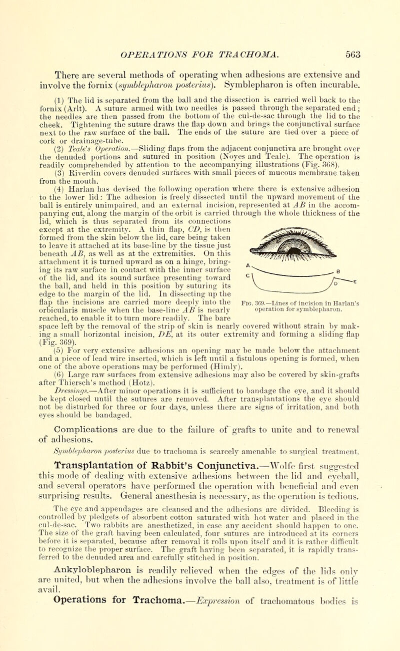 There are several methods of operating when adhesions are extensive and involve the fornix {symblepharon posterius). Symblepharon is often incurable. (1) The lid is separated from the ball and the dissection is carried well back to the fornix (Arlt). A suture armed with two needles is passed through the separated end ; the needles are then passed from the bottom of the cul-de-sac through the lid to the cheek. Tightening the suture draws the flap down and brings the conjunctival surface next to the raw surface of the ball. The ends of the suture are tied over a piece of cork or drainage-tube. (2) Teak's Operation.—Sliding flaps from the adjacent conjunctiva are brought over the denuded portions and sutured in position (Noyes and Teale). The operation is readily comprehended by attention to the accompanying illustrations (Fig. 368). (3) Riverdin covers denuded surfaces with small pieces of mucous membrane taken from the mouth. (4) Harlan has devised the following operation where there is extensive adhesion to the lower lid: The adhesion is freely dissected until the upward movement of the ball is entirely unimpaired, and an external incision, represented at AB in the accom- panying cut, along the margin of the orbit is carried through the whole thickness of the lid, which is thus separated from its connections except at the extremity. A thin flap, CD, is then formed from the skin below the lid, care being taken to leave it attached at its base-line by the tissue just beneath AB, as well as at the extremities. On this attachment it is turned upward as on a hinge, bring- ing its raw surface in contact with the inner surface of the lid, and its sound surface presenting toward the ball, and held in this position by suturing its edge to the margin of the lid. In dissecting up the flap the incisions are carried more deeply into the fig. 369.—Lines of incision in Harlan's orbicularis muscle when the base-line AB is nearly operation for symblepharon. reached, to enable it to turn more readily. The bare space left by the removal of the strip of skin is nearly covered without strain by mak- ing a small horizontal incision, BE, at its outer extremity and forming a sliding flap (Fig. 369). (5) For very extensive adhesions an opening may be made below the attachment and a piece of lead wire inserted, which is left until a fistulous opening is formed, when one of the above operations may be performed (Hinily). (6) Large raw surfaces from extensive adhesions may also be covered by skin-grafts after Thiersch's method (Hotz). Dressings.—After minor operations it is sufficient to bandage the eye, and it should be kept closed until the sutures are removed. After transplantations the eye should not be disturbed for three or four days, unless there are signs of irritation, and both eyes should be bandaged. Complications are due to the failure of grafts to unite and to renewal of adhesions. Symblepharon posterius due to trachoma is scarcely amenable to surgical treatment. Transplantation of Rabbit's Conjunctiva.—Wolfe first suggested this mode of dealing with extensive adhesions between the lid and eyeball, and several operators have performed the operation with beneficial and even surprising results. General anesthesia is necessary, as the operation is tedious. The eye and appendages are cleansed and the adhesions are divided. Bleeding is controlled by pledgets of absorbent cotton saturated with hot water and placed in the cul-de-sac. Two rabbits are anesthetized, in case any accident should happen to one. The size of the graft having been calculated, four sutures are introduced at its corners before it is separated, because after removal it rolls upon itself and it is rather difficult to recognize the proper surface. The graft having been separated, it is rapidly trans- ferred to the denuded area and carefully stitched in position. Ankyloblepharon is readily relieved when the edges of the lids only are united, hut when the adhesions involve the ball also,treatment is of little avail. Operations for Trachoma.— Expression of trachomatous bodies is