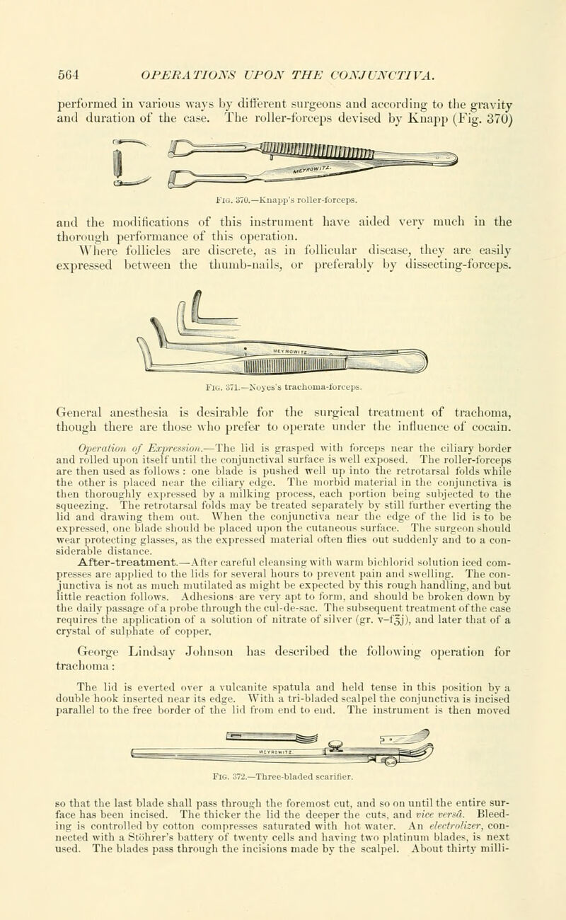 performed in various ways by different surgeons and according to the gravity and duration of the case. The roller-forceps devised by Knapp (Fig. 370) Fig. 370.—Knapp's roller-furceps. and the modifications of this instrument have aided very much in the thorough performance of this operation. Where follicles are discrete, as in follicular disease, they are easily expressed between the thumb-nails, or preferably by dissecting-forceps. General anesthesia is desirable for the surgical treatment of trachoma, though there are those who prefer to operate under the influence of cocain. Operation <;/' Expression.—The lid is grasped with forceps near the ciliary border and rolled upon itself until the conjunctival surface is well exposed. The roller-forceps are then used as follows : one blade is pushed well up into the retrotarsal folds while the other is placed near the ciliary edge. The morbid material in the conjunctiva is then thoroughly expressed by a milking process, each portion being subjected to the squeezing. The retrotarsal folds may be treated separately by still further everting the lid and drawing them out. When the conjunctiva near the edge of the lid is to be expressed, one blade should be placed upon the cutaneous surface. The surgeon should wear protecting glasses, as the expressed material often flies out suddenly and to a con- siderable distance. After-treatment.—After careful cleansing with warm biehlorid solution iced com- presses are applied to the lids for several hours to prevent pain and swelling. The con- junctiva is not as much mutilated as might be expected by this rough handling, and but little reaction follows. Adhesions are very apt to form, and should be broken down by the daily passage of a probe through the cul-de-sac. The subsequent treatment of the case requires the application of a solution of nitrate of silver (gr. v-fgj), and later that of a crystal of sulphate of copper. George Lindsay Johnson has described the following operation for trachoma : The lid is everted over a vulcanite spatula and held tense in this position by a double hook inserted near its edge. With a tri-bladed scalpel the conjunctiva is incised parallel to the free border of the lid from end to end. The instrument is then moved Fig. 372.—Th Mndcl vrriiilirr. so that the last blade shall pass through the foremost cut, and so on until the entire sur- face has been incised. The thicker the lid the deeper the cuts, and vice verm. Bleed- ing is controlled by cotton compresses saturated with hot water. An elect ml iter, con- nected with a Stohrer's battery of twenty cells and having two platinum blades, is next used. The blades pass through the incisions made by the scalpel. About thirty milli-