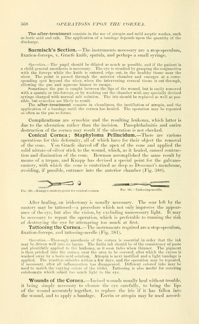 The after-treatment consists in the use of atropin and mild aseptic washes, such as boric acid and salt. The application of a bandage depends upon the quantity of the discharge. Saemisch's Section.—The instruments necessary are a stop-speculum, fixation-forceps, v. Graefe knife, spatula, and perhaps a small syringe. Operation.—The pupil should be dilated as much as possible, and if the patient is a child general anesthesia is necessary. The eye is steadied by grasping the conjunctiva with the forceps while the knifo is entered, edge out, in the healthy tissue near the ulcer. The point is passed through the anterior chamber and emerges at a corre- sponding spot beyond the ulcer, when the intervening corneal tissue is cut through, allowing the pus and aqueous humor to escape. Sometimes the pus is caught between the lips of the wound, but is easily removed with a spatula or iris-forceps, or by washing out the chamber with any specially devised syringe charged with normal salt solution. The iris should be replaced as well as pos- sible, but synechia' are likely to result. The after-treatment consists in cleanliness, the instillation of atropin, and the application of a bandage until the cornea has healed. The operation may be repeated as often as the pus re-forms. Complications are synechia? and the resulting leukoma, which latter is due to the ulceration rather than the incision. Panophthalmitis and entire destruction of the cornea may result if the ulceration is not cheeked. Conical Cornea; Staphyloma Pellucidum.—There are various operations for this deformity, all of which have for their object the removal of the cone. Von Graefe shaved off the apex of the cone and applied the solid nitrate-of-silver stick to the wound, which, as it healed, caused contrac- tion and diminution of the cone. Bowman accomplished the same result by means of a trepan, and Knapp has devised a special point for the galvano- cautery, witli which the cone is cauterized as deep as Descemet's membrane, avoiding, if possible, entrance into the anterior chamber (Fig. .380). -Tattooing-needle. Fig. 380.—Knapp's cautery-point for conical cornea. After healing, an iridectomy is usually necessary. The scar left by the cautery may be tattooed—a procedure which not only improves the appear- ance of the eye, but also the vision, by excluding unnecessary light. It may be necessary to repeat the operation, which is preferable to running the risk of destroying the eye by attempting too much at first. Tattooing the Cornea.—The instruments required area stop-speculum, fixation-forceps, and tattooing-needle (Fig. 381). Operation.—Thorough anesthesia of the cornea is essential in order that the ink may be. driven well into its layers. The India ink should be of the consistency of paste and plentifully applied to the leukoma, as it soon fades when thinner. The pigment is then pricked into the cornea over the area to be covered, after which the excess is washed away by a boric-acid solution. Atropin is next instilled and a light bandage is applied. The reaction sub-ides within a few days, and the operation may be repeated, if necessary, after all inflammation has disappeared. Different colored inks may be used to match the varying colors of the irides. Tattooing is also useful for covering colobomata which admit too much light to the eye. Wounds of the Cornea.—Incised wounds usually heal without trouble, it being simply necessary to cleanse the eye carefully, to bring the lips of the wound accurately together, to replace the iris if it lias fallen into the wound, and to apply a bandage. Eserin or atropin may be used accord-