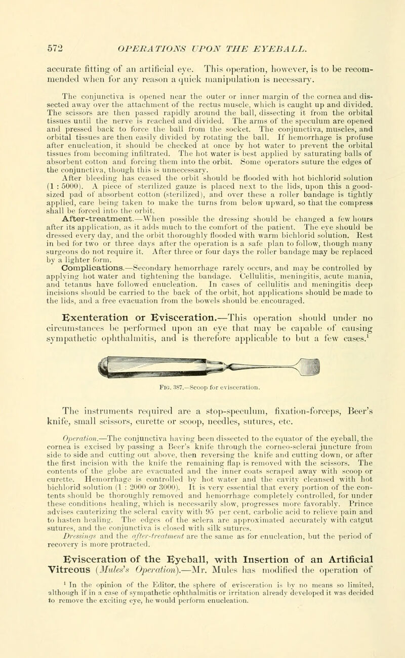 accurate fitting of an artificial eye. This operation, however, is to be recom- mended when for any reason a quick manipulation is necessary. The conjunctiva is opened near the outer or inner margin of the cornea and dis- sected away over the attachment of the rectus muscle, which is caught up and divided. The scissors are then passed rapidly around the ball, dissecting it from the orbital tissues until the nerve is reached and divided. The arms of the speculum are opened and pressed back to force the ball from the socket. The conjunctiva, muscles, and orbital tissues are then easily divided by rotating the ball. If hemorrhage is profuse after enucleation, it should be checked at once by hot water to prevent the orbital tissues from becoming infiltrated. The hot water is best applied by saturating balls of absorbent cotton and forcing them into the orbit. Some operators suture the edges of the conjunctiva, though this is unnecessary. After bleeding has ceased the orbit should be Hooded with hot biehlorid solution (1 : 50U0). A piece of sterilized gauze is placed next to the lids, upon this a good- sized pad of absorbent cotton (sterilized), and over these a roller bandage is tightly applied, care being taken to make the turns from below upward, so that the compress shall be forced into the orbit. After-treatment.—When possible the dressing should be changed a few hours after its application, as it adds much to the comfort of the patient. The eye should be dressed every day, and the orbit thoroughly Hooded with warm biehlorid solution. Rest in bed for two or three days after the operation is a safe plan to follow, though many surgeons do not require it. After three or four days the roller bandage may be replaced by a lighter form. Complications.—Secondary hemorrhage rarely occurs, and may be controlled by applying hot water and tightening the bandage. Cellulitis, meningitis, acute mania, and tetanus have followed enucleation. In cases of cellulitis and meningitis deep incisions should be carried to the back of the orbit, hot applications should be made to the lids, and a free evacuation from the bowels should be encouraged. Exenteration or Evisceration.—This operation should under no circumstances he performed upon an eye that may he capable of causing sympathetic ophthalmitis, and is therefore applicable to but a few cases.1 FIG. 3S7.-Scoop for evisceration. The instruments required are a stop-speculum, fixation-forceps, Beer's knife, small scissors, curette or scoop, needles, sutures, etc. Operation.—The conjunctiva having been dissected to the equator of the eyeball, the cornea is excised by passing a Beer's knife through the corneo-scleral juncture from side to side and cutting out above, then reversing the knife and cutting down, or after the first incision with the knife the remaining flap is removed with the scissors. The contents (jf the globe are evacuated and the inner coats scraped away with scoop or curette. Hemorrhage is controlled by hot water and the cavity cleansed with hot biehlorid solution (1 : 2000 or 30U0). It is very essential that every portion of the con- tents should be thoroughly removed and hemorrhage completely controlled, for under these conditions healing, which is necessarily slow, progresses more favorably. Prince advises cauterizing the scleral cavity with !•.> per cent, carbolic acid to relieve pain and to hasten healing. The edges of the sclera arc approximated accurately with catgut sutures, and the conjunctiva is closed with silk sutures. Dressings and the after-treatment are the same as for enucleation, but the period of recovery is more protracted. Evisceration of the Eyeball, with Insertion of an Artificial Vitreous (Mutes's Operation).—Mr. Mules lias modified the operation of ' In the opinion of the Editor, the sphere of evisceration is by no means so limited, although if in a case of sympathetic ophthalmitis or irritation already developed it was decided to remove the exciting eye, he would perform enucleation.