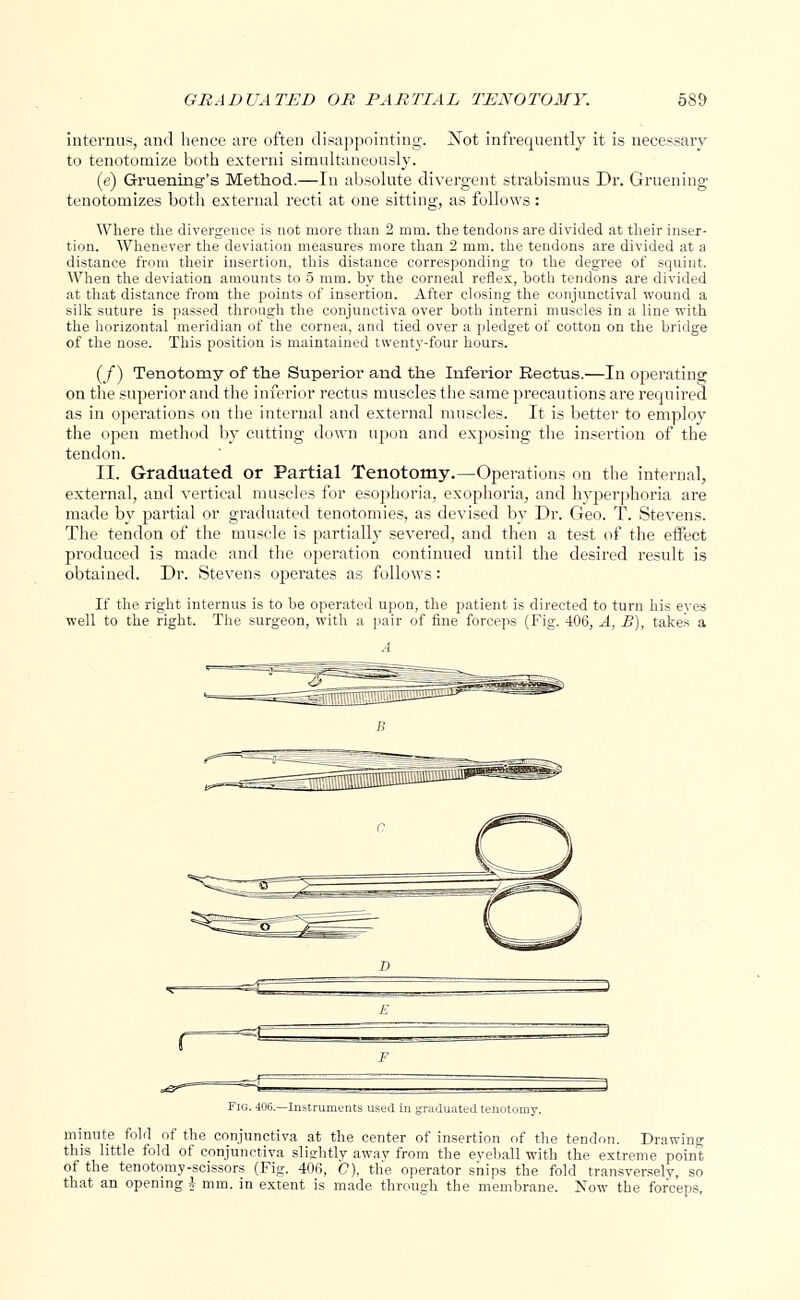 GRADUATED OR PARTIAL TENOTOMY. 58& interims, and hence are often disappointing. Not infrequently it is necessary to tenotomize both externi simultaneously. (e) Gruening's Method.—In absolute divergent strabismus Dr. Gruening tenotomizes both external recti at one sitting, as follows: Where the divergence is not more than 2 mm. the tendons are divided at their inser- tion. Whenever the deviation measures more than 2 mm. the tendons are divided at a distance from their insertion, this distance corresponding to the degree of squint. When the deviation amounts to 5 mm. by the corneal reflex, both tendons are divided at that distance from the points of insertion. After closing the conjunctival wound a silk suture is passed through the conjunctiva over both interni muscles in a line with the horizontal meridian of the cornea, and tied over a pledget of cotton on the bridge of the nose. This position is maintained twenty-four hours. (/) Tenotomy of the Superior and the Inferior Rectus.—In operating on the superior and the inferior rectus muscles the same precautions are required as in operations on the internal and external muscles. It is better to employ the open method by cutting down upon and exposing the insertion of the tendon. II. Graduated or Partial Tenotomy.—Operations on the internal, external, and vertical muscles for esophoria, exophoria, and hyperphoria are made by partial or graduated tenotomies, as devised by Dr. Geo. T. Stevens. The tendon of the muscle is partially severed, and then a test of the effect produced is made and the operation continued until the desired result is obtained. Dr. Stevens operates as follows : If the right internus is to be operated upon, the patient is directed to turn his eyes well to the right. The surgeon, with a pair of fine forceps (Fig. 406, A, B), takes a Fig. 406.—Instruments used iduated tenotomy. minute fold of the conjunctiva at the center of insertion of the tendon. Drawing this little fold of conjunctiva slightly awav from the eyeball with the extreme point of the tenotomy-scissors (Fig. 406, <?), the operator ships the fold transversely, so that an opening J mm. in extent is made through the membrane. Now the forceps,