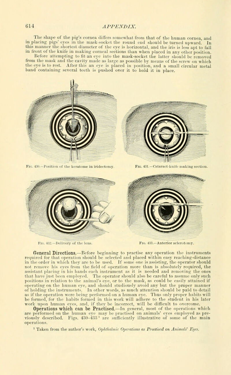 The shape of the pig's cornea differs somewhat from that of the human cornea, and in placing [jigs' eyes in the mask-socket the round end should be turned upward. In this manner the shortest diameter of the eye is horizontal, and the iris is less apt to fall in front of the knife in making corneal sections than when placed in any other position. Before attempting to fit an eye into the mask-socket the latter should be removed from the mask and the cavity made as large as possible by means of the screw on which the eye is to rest. After this an eye is placed in position, and a small circular metal band containing several teeth is pushed over it to hold it in place. Fig. 430.—Position of the keratome in iridectomy. Delivery of the lens. Fig. 433.—Anterior sclerotomy. General Directions.—Before beginning to practise any operation the instruments required lor that operation should be selected and placed within easy reaching-distance in the order in which they are to be used. If some one is assisting, the operator should not remove his eyes from the field of operation more than is absolutely required, the assistant placing in his hands each instrument as it is needed and removing the ones that have just been employed. The operator should also be careful to assume only such positions in relation to the animal's eye, or to the mask, as could be easily attained if operating on the human eye, and should studiously avoid any but the proper manner of holding the instruments. In other words, as much attention should be paid to detail as if the operation were being performed on a human eye. Thus only proper habits will be formed, for the habits formed in this work will adhere to the student in his later work upon human eyes, and, if they be incorrect, will be difficult to overcome. Operations which can be Practised.—In general, most of the operations which are performed on the human eye may be practised on animals' eyes employed as pre- viously described. Figs. 430-433 ' are sufficiently illustrative of some of the main operations. 1 Taken from the author's work, Ophthalmic Operations as Practised on Animals' Eyes.