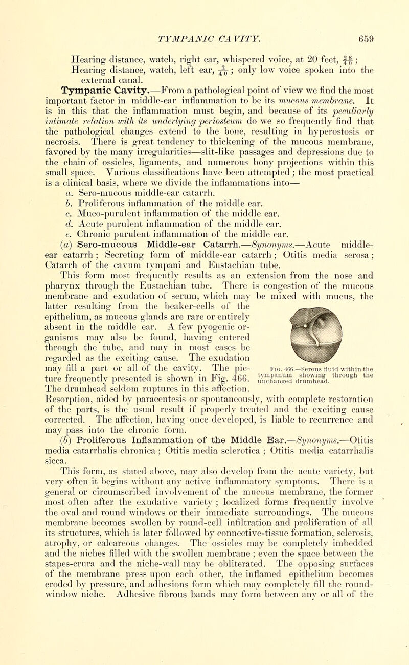 Hearing distance, watch, right ear, whispered voice, at 20 feet, |~|; Hearing distance, watch, left ear, -^; only low voice spoken into the external canal. Tympanic Cavity.—From a pathological point of view we find the most important factor in middle-ear inflammation to be its mucous membrane. It is in this that the inflammation must begin, and because of its peculiarly intimate relation with its underlying periosteum do we so frequently find that the pathological changes extend to the bone, resulting in hyperostosis or necrosis. There is great tendency to thickening of the mucous membrane, favored by the many irregularities—slit-like passages and depressions clue to the chain of ossicles, ligaments, and numerous bony projections within this small space. Various classifications have been attempted ; the most practical is a clinical basis, where we divide the inflammations into— a. Sero-mucous middle-ear catarrh. b. Proliferous inflammation of the middle ear. c. Muco-purulent inflammation of the middle ear. d. Acute purulent inflammation of the middle ear. e. Chronic purulent inflammation of the middle ear. («) Sero-mucous Middle-ear Catarrh.—Synonyms.—Acute middle- ear catarrh; Secreting form of middle-ear catarrh; Otitis media serosa; Catarrh of the cavum tympani and Eustachian tube. This form most frequently results as an extension from the nose and pharynx through the Eustachian tube. There is congestion of the mucous membrane and exudation of serum, which may be mixed with mucus, the latter resulting from the beaker-cells of the epithelium, as mucous glands are rare or entirely absent in the middle ear. A few pyogenic or- ganisms may also be found, having entered through the tube, and may in most cases be regarded as the exciting cause. The exudation may fill a part or all of the cavity. The pic- fig. 466.—Serous fluid within the ture frequently presented is shown in Fig. 466. SSESSS d™B. thr°ugh the The drumhead seldom ruptures in this affection. Resorption, aided by paracentesis or spontaneously, with complete restoration of the parts, is the usual result if properly treated and the exciting cause corrected. The affection, having once developed, is liable to recurrence and may pass into the chronic form. (b) Proliferous Inflammation of the Middle Ear.—Synonyms.—Otitis media catarrhalis chronica ; Otitis media sclerotica ; Otitis media catarrhalis sicca. This form, as stated above, may also develop from the acute variety, but very often it begins without any active inflammatory symptoms. There is a general or circumscribed involvement of the mucous membrane, the former most often after the exudative variety ; localized forms frequently involve the oval and round windows or their immediate surroundings. The mucous membrane becomes swollen by round-cell infiltration and proliferation of all its structures, which is later followed by connective-tissue formation, sclerosis, atrophy, or calcareous changes. The ossicles may be completely imbedded and the niches filled with the swollen membrane ; even the space between the stapes-crura and the niche-wall may be obliterated. The opposing surfaces of the membrane press upon each other, the inflamed epithelium becomes eroded by pressure, and adhesions form which may completely fill the round- window niche. Adhesive fibrous bands may form between any or all of the