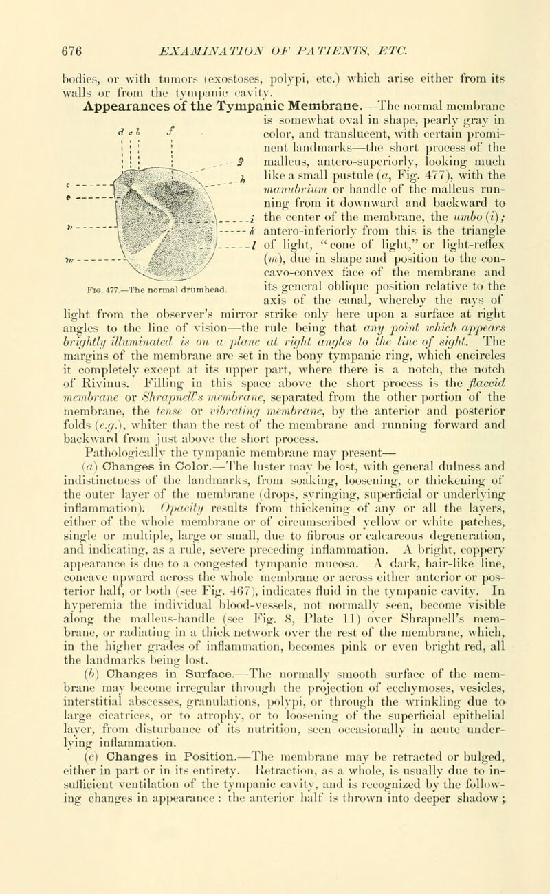 bodies, or with tumors (exostoses, polypi, etc.) which arise either from its walls or from the tympanic cavity. Appearances of the Tympanic Membrane.—The normal membrane is somewhat oval in shape, pearly gray in <? <•s  color, and translucent, with certain promi- i ; ; ; nent landmarks—the short process of the ; ■ ! • 9 malleus, antero-supcriorly, looking much J ^ like a small pustule (a, Fig. 477), with the 1 %.u ; '»v^ manubrium or handle of the malleus run- ning from it downward and backward to ,• the center of the membrane, the umbo (i); # antero-inferiorly from this is the triangle — / of light, cone of light, or light-reflex (m), due in shape and position to the con- cavo-convex face of the membrane and fig.477-Then^Iidrumhead. its general oblicpic position relative to the axis of the canal, whereby the rays of light from the observer's mirror strike only here upon a surface at right angles to the line of vision—the rule being that any point which appears brightly illuminated in on a plane at right angles to the line of sight. The margins of the membrane are set in the bony tympanic ring, which encircles it completely except at its upper part, where there is a notch, the notch of Rivinus. Filling in this space above the short process is the flaccid membrane or ShrapneU's membrane, separated from the other portion of the membrane, the tense, or vibrating membrane, by the anterior and posterior folds (e.g.), whiter than the rest of the membrane and running forward and backward from just above the short process. Pathologically the tympanic membrane may present— (a) Changes in Color.—The luster may be lost, with general dulness and indistinctness of the landmarks, from soaking, loosening, or thickening of the outer layer of the membrane (drops, syringing, superficial or underlying inflammation). Opacity results from thickening of any or all the layers, either of the whole membrane or of circumscribed yellow or white patches, single or multiple, large or small, due to fibrous or calcareous degeneration, and indicating, as a rule, severe preceding inflammation. A bright, coppery appearance is due to a congested tympanic mucosa. A dark, hair-like line, concave upward across the whole membrane or across either anterior or pos- terior half, or both (see Fig. 467), indicates fluid in the tympanic cavity. In hyperemia the individual blood-vessels, not normally seen, become visible along the malleus-handle (see Fig. 8, Plate 11) over ShrapneU's mem- brane, or radiating in a thick network over the rest of the membrane, which, in the higher grades of inflammation, becomes pink or even bright red, all the landmarks being lost. (b) Changes in Surface.—The normally smooth surface of the mem- brane may become irregular through the projection of ecchymoses, vesicles, interstitial abscesses, granulations, polypi, or through the wrinkling due to large cicatrices, or to atrophy, or to loosening of the superficial epithelial layer, from disturbance of its nutrition, seen occasionally in acute under- lying inflammation. (c) Changes in Position.—The membrane may be retracted or bulged, either in part or in its entirety. Retraction, as a whole, is usually due to in- sufficient ventilation of the tympanic cavity, and is recognized by the follow- ing changes in appearance: the anterior half is thrown into deeper shadow;