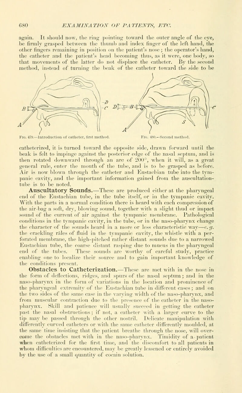 again. It should now, the ring pointing toward the outer angle of the eye, be firmly grasped between the thumb and index finger of the left hand, the other fingers remaining in position on the patient's nose; the operator's hand, the catheter and the patient's head becoming thus, as it were, one body, so that movements of the latter do not displace the catheter. By the second method, instead of turning the beak of the catheter toward the side to be Fig. 479.—Introduction of catheter, lirst method. Fig. 4S0.—Second method. catheterized, it is turned toward the opposite side, drawn forward until the beak is felt to impinge against the posterior edge of the nasal septum, and is then rotated downward through an arc of 200°, when it will, as a great general rule, enter the mouth of the tube, and is to be grasped as before. Air is now blown through the catheter and Eustachian tube into the tym- panic cavity, and the important information gained from the auscultation- tube is to be noted. Auscultatory Sounds.—These are produced either at the pharyngeal end of the Eustachian tube, in the tube itself, or in the tympanic cavity. With the parts in a normal condition there is heard with each compression of the air-bag a soft, dry, blowing sound, together with a slight thud or impact sound of the current of air against the tympanic membrane. Pathological conditions in the tympanic cavity, in the tube, or in the naso-pharynx change the character of the sounds heard in a more or less characteristic way—e.g. the crackling rales of fluid in the tympanic cavity, the whistle with a per- forated membrane, the high-pitched rather distant sounds due to a narrowed Eustachian tube, the coarse distant rasping due to mucus in the pharyngeal end of the tubes. These sounds arc worthy of careful study, practice enabling one to localize their source and to gain important knowledge of the conditions present. Obstacles to Catheterization.—These are met with in the nose in the form of deflections, ridges, and spurs of the nasal septum; and in the naso-pharynx in the form of variations in the location and prominence of the pharyngeal extremity of the Eustachian tube in different cases; and on the two sides of the same case in the varying width of the naso-pharynx, and from muscular contraction due to the presence of the catheter in the naso- pharynx. Skill and patience will usually succeed in getting the catheter past the nasal obstructions; if not, a catheter with a larger curve to the tip maybe passed through the other nostril. Delicate manipulation with differently curved catheters or with the same catheter differently moulded, at the same time insisting that the patient breathe through the nose, will over- come the obstacles met with in the naso-pharynx. Timidity of a-patient when catheterized for the first time, and the discomfort to all patients in whom difficulties are encountered, may be greatly lessened or entirely avoided by the use of a small quantity of cocain solution.