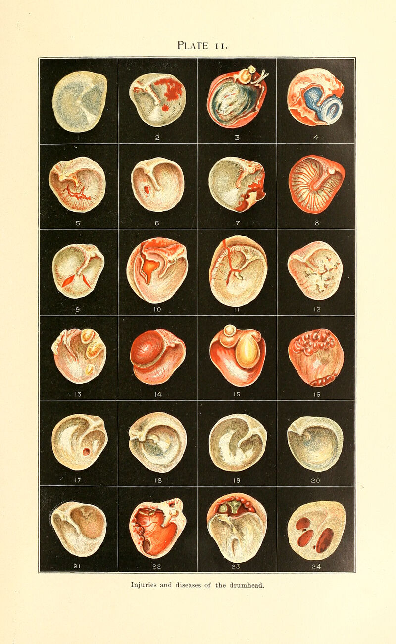 Injuries and diseases of the drumhead.