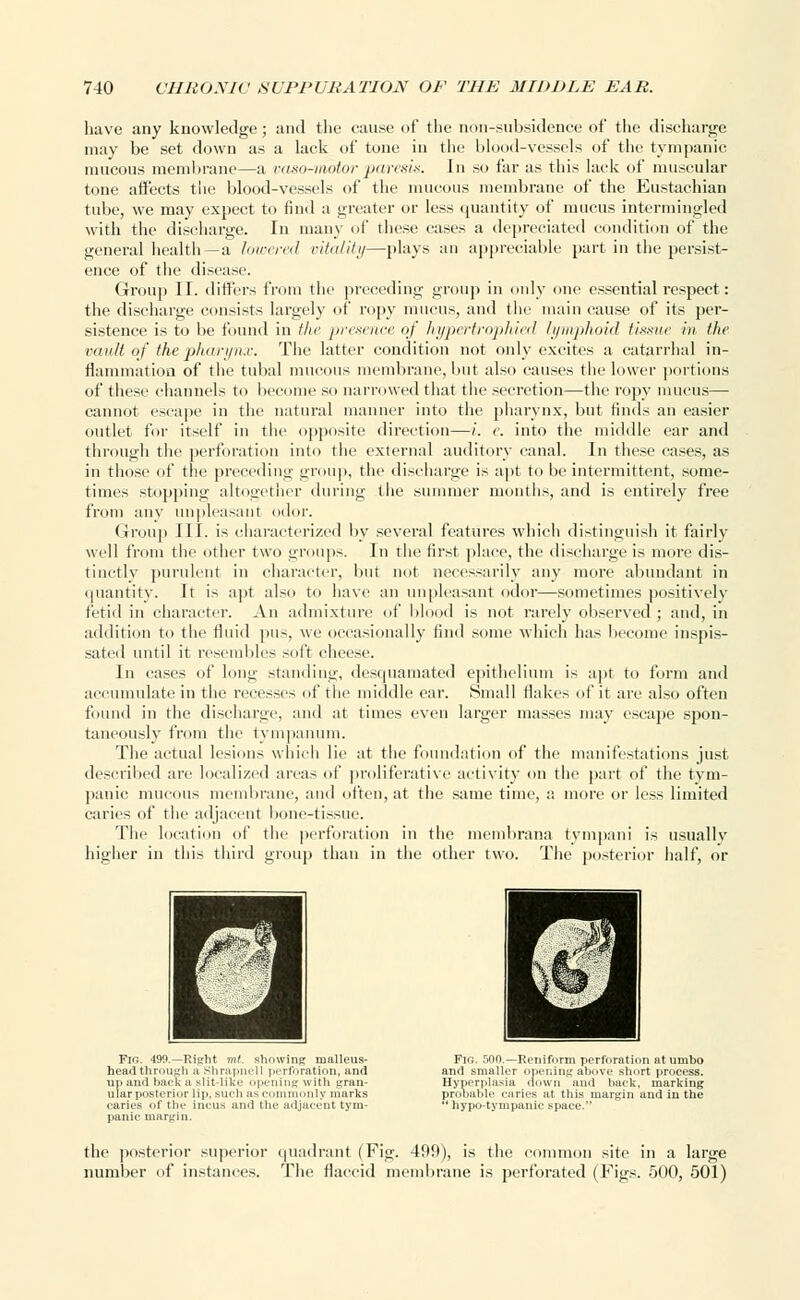have any knowledge; and the cause of the non-subsidence of the discharge may be set down as a lack of tone in the blood-vessels of the tympanic mucous membrane—a vaso-motor paresis. In so far as this lack of muscular tone affects the blood-vessels of the mucous membrane of the Eustachian tube, we may expect to find a greater or less quantity of mucus intermingled with the discharge. In many of these cases a depreciated condition of the general health—a lowered vitality—plays an appreciable part in the persist- ence of the disease. Group II. differs from the preceding group in only one essential respect: the discharge consists largely of ropy mucus, and the main cause of its per- sistence is to be found in the presence of hypertrophied lymphoid tissue in the vault of the pharynx. The latter condition not only excites a catarrhal in- flammation of the tubal mucous membrane, but also causes the lower portions of these channels to become so narrowed that the secretion—the ropy mucus— cannot escape in the natural manner into the pharynx, but finds an easier outlet for itself in the opposite direction—i. c. into the middle ear and through the perforation into the external auditory canal. In these cases, as in those of the preceding group, the discharge is apt to be intermittent, some- times stopping altogether during the summer months, and is entirely free from any unpleasant odor. Group III. is characterized by several features which distinguish it fairly well from the other two groups. In the first place, the discharge is more dis- tinctly purulent in character, but not necessarily any more abundant in quantity. It is apt also to have an unpleasant odor—sometimes positively fetid in character. An admixture of blood is not rarely observed ; and, in addition to the fluid pus, we occasionally find some which has become inspis- sated until it resembles soft cheese. In cases of long standing, desquamated epithelium is apt to form and accumulate in the recesses of the middle car. Small flakes of it are also often found in the discharge, and at times even larger masses may eseaj>e spon- taneously from tlie tympanum. The actual lesions which lie at the foundation of the manifestations just described are localized areas of proliferative activity on the part of the tym- panic mucous membrane, and often, at the same time, a more or less limited caries of the adjacent bone-tissue. The location of the perforation in the membrana tympani is usually higher in this third group than in the other two. The posterior half, or Fie. 499.—Right mt. showing malleus- head through a Shrapncll perforation, and up and baek a slit-like opening with gran- ular posterior lip. sueh as commonly marks caries of the incus and the adjacent tym- panic margin. Fig. 500.—Reniform perforation at umbo and smaller opening above short process. Hyperplasia down and back, marking prooable caries at this margin and in the  hypo-tympanic space. the posterior superior quadrant (Fig. 499), is the common site in a large number of instances. The flaccid membrane is perforated (Figs. 500, 501)