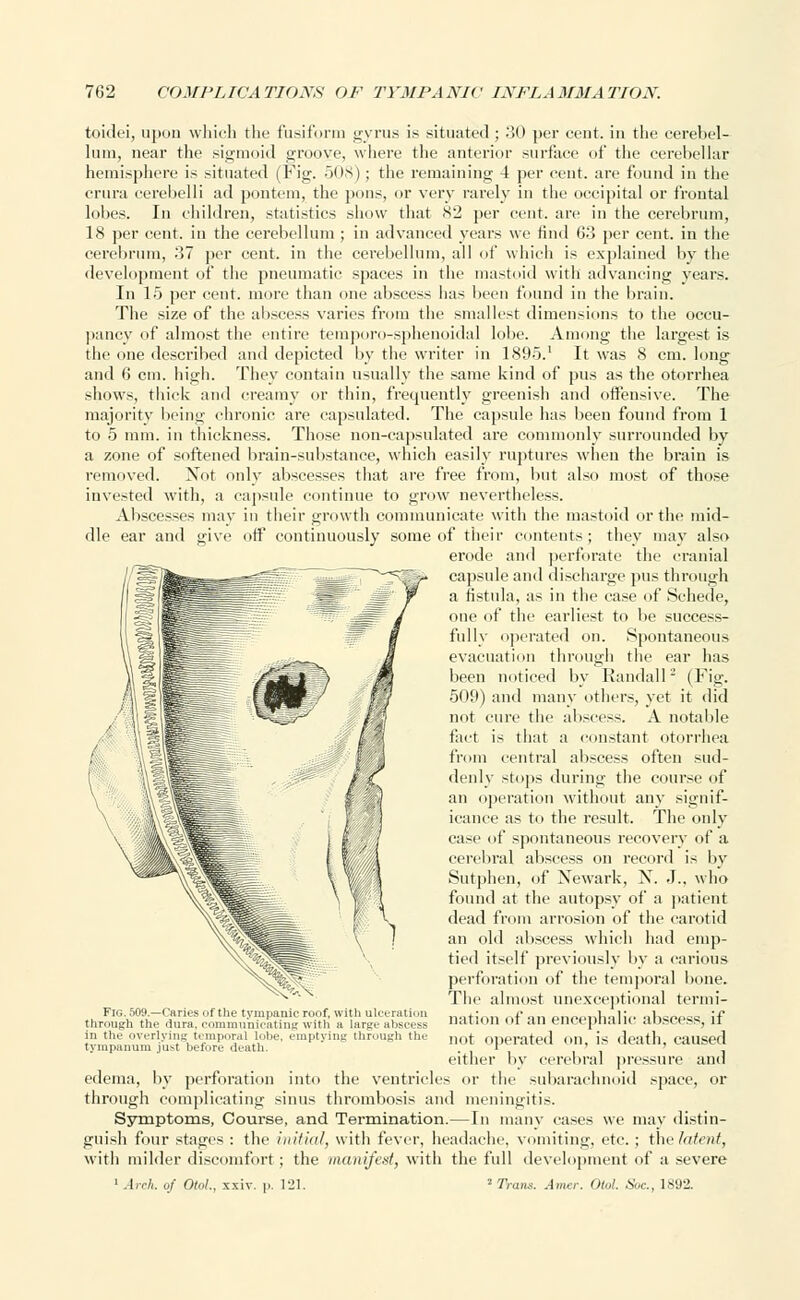 toidei, upon which the fusiform gyrus is situated ; 30 per cent, in the cerebel- lum, near the sigmoid groove, where the anterior surface of the cerebellar hemisphere is situated (Fig. 508) ; the remaining 4 per cent, are found in the crura cerebelli ad pontem, the pons, or very rarely in the occipital or frontal lobes. In children, statistics show that 82 per cent, are in the cerebrum, 18 per cent, in the cerebellum ; in advanced years we find 63 per cent, in the cerebrum, 37 per cent, in the cerebellum, all of which is explained by the development of the pneumatic spaces in the mastoid with advancing years. In 15 per cent, more than one abscess has been found in the brain. The size of the abscess varies from the smallest dimensions to the occu- pancy of almost the entire temporo-sphenoidal lobe. Among the largest is the one described and depicted by the writer in 1895.' It was 8 cm. long and 6 cm. high. They contain usually the same kind of pus as the otorrhea shows, thick and creamy or thin, frequently greenish and offensive. The majority being chronic are capsulated. The capsule has been found from 1 to 5 mm. in thickness. Those non-capsulated are commonly surrounded by a zone of softened brain-substance, which easily ruptures when the brain is removed. Not only abscesses that are free from, but also most of those invested with, a capsule continue to grow nevertheless. Abscesses may in their growth communicate with the mastoid or the mid- dle ear and give off continuously some of their contents; they may also erode and perforate the cranial capsule and discharge pus through a fistula, as in the case of Schede, one of the earliest to be success- fully operated on. Spontaneous evacuation through the ear lias been noticed by Randall3 (Fig. 509) and many others, yet it did not cure tlie abscess. A notable fart is that a constant otorrhea from central abscess often sud- denly stops during the course of an operation without any signif- icance as to the result. The only case of spontaneous recovery of a cerebral abscess on record is by Sutphen, of Xewark, N. J., who found at the autopsy of a patient dead from arrosion of the carotid an old abscess which had emp- tied itself previously by a carious perforation of the temporal bone. The almost unexceptional termi- nation of an encephalic abscess, if not operated on, is death, caused either by cerebral pressure and edema, by perforation into the ventricles or the subarachnoid space, or through complicating sinus thrombosis and meningitis. Symptoms, Course, and Termination.—In many cases we may distin- guish four stages : the initial, with fever, headache vomiting, etc. ; the//'/'/, with milder discomfort; the manifest, with the full development of a severe 1 Arch, of OtoL, xxiv. \<. 121. 2 Trans. Amer. Old. Soc, 1892. Fig. 509.—Caries (if the tympanic roof, with ulceration through the dura, communicating with a large abscess in the overlying temporal lobe, emptying through the tympanum just before death.