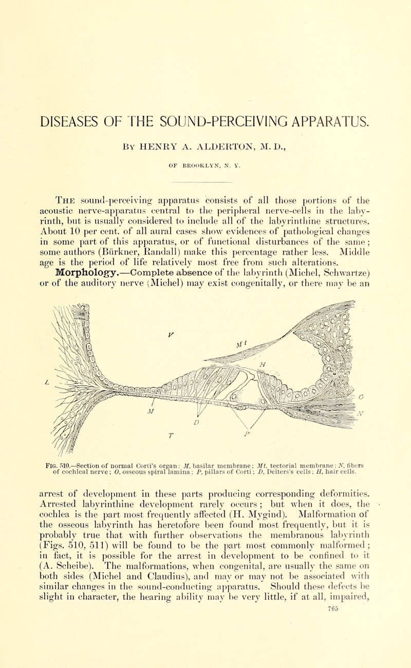 DISEASES OF THE SOUND-PERCEIVING APPARATUS. By HENRY A. ALDERTON, M. D., OF BROOKLYN, N. Y. The sound-perceiving apparatus consists of all those portions of the acoustic nerve-apparatus central to the peripheral nerve-cells in the laby- rinth, but is usually considered to include all of the labyrinthine structures. About 10 per cent, of all aural cases show evidences of pathological changes in some part of this apparatus, or of functional disturbances of the same; some authors (Biirkner, Randall) make this percentage rather less. Middle age is the period of life relatively most free from such alterations. Morphology.—Complete absence of the labyrinth (Michel, Schwartze) or of the auditory nerve (Michel) may exist congenitally, or there may be an Fig. 510.—Section of normal Corti's organ: M, basilar membrane; Ml, tectorial membrane . iV, fibers of cochleal nerve; 0, osseous spiral lamina; P, pillars of Corti; D, Deiters's cells; H, hair cells. arrest of development in these parts producing corresponding deformities. Arrested labyrinthine development rarely occurs; but when it does, the cochlea is the part most frequently affected (H. Mygind). Malformation of the osseous labyrinth has heretofore been found most frequently, but it is probably true that with further observations the membranous labyrinth (Figs. 510, 511) will be found to be the part most commonly malformed; in fact, it is possible for the arrest in development to be confined to it (A. Scheibe). The malformations, when congenital, are usually the same on both sides (Michel and Claudius), and may or may not be associated with similar changes in the sound-conducting apparatus. Should these defects be slight in character, the hearing ability may be very little, if at all, impaired,