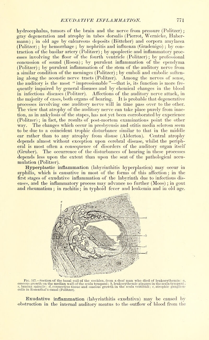 hydrocephalus, tumors of the brain and the nerve from pressure (Politzer); gray degeneration and atrophy in tabes dorsalis (Pierrot, Wernicke, Haber- mann) ; in old age by calcareous deposits (Bottcher) and corpora amylacea (Politzer); by hemorrhage ; by nephritis and influenza (Gradenigo); by con- traction of the basilar artery (Politzer); by apoplectic and inflammatory proc- esses involving the floor of the fourth ventricle (Politzer); by professional concussion of sound (Roosa); by purulent inflammation of the ependyma (Politzer); by purulent inflammation of the stem of the auditory nerve from a similar condition of the meninges (Politzer); by emboli and embolic soften- ing along the acoustic nerve tracts (Politzer). Among the nerves of sense, the auditory is the most  impressionable —that is, its function is more fre- quently impaired by general diseases and by chemical changes in the blood in infectious diseases (Politzer). Affections of the auditory nerve attack, in the majority of cases, botli organs of hearing. It is probable that degenerative processes involving one auditory nerve will in time pass over to the other. The view that atrophy of the auditory nerve can take place purely from inac- tion, as in ankylosis of the stapes, has not yet been corroborated by experience (Politzer); in fact, the results of post-mortem examinations point the other way. The changes which occur in presbycusis and otitis media sclerosa seem to be due to a coincident trophic disturbance similar to that in the middle ear rather than to any atrophy from disuse (Alderton). Central atrophy depends almost without exception upon cerebral disease, whilst the periph- eral is most often a consequence of disorders of the auditory organ itself (Gruber). The occurrence of the disturbances of hearing in these processes depends less upon the extent than upon the seat of the pathological accu- mulation (Politzer). Hyperplastic inflammation (labyrinthitis hyperplastica) may occur in syphilis, which is causative in most of the forms of this affection ; in the first stages of exudative inflammation of the labyrinth due to infectious dis- eases, and the inflammatory process may advance no further (Moos); in gout and rheumatism; in rachitis; in typhoid fever and leukemia and in old age. Fig. 517.—Section of the basal coil of the cochlea, from a deaf man who died of leukocythemia: a. osseous growth on the median wall of the scala tynipani; b, leukocythemic plaques in the scala tympani; c, lamina spiralis; d, connective tissue and osseous growth in the scala vestlbuli; e, atrophic ganglion- cells in Rosenthal's canal (Politzer). Exudative inflammation (labyrinthitis exudativa) may be caused by obstruction in the internal auditory meatus to the outflow of blood from the