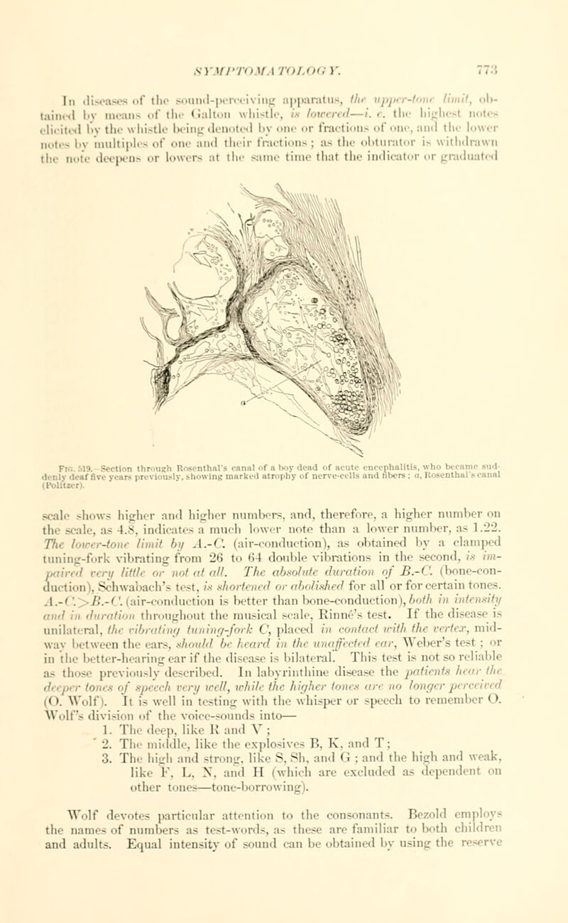 SYMPTOM I TO] 00 Y :.: lii diseases of the sound-perceiving apparatus, tiu upper-ton* Until, ob- tained by means of the Galton whistle, is lowered—i.e. the highest notes elicited by tli«' \\ histle I►. iiil; denoted by one or fractions of one, and the lower notes by multiples of one and their fractions ; as the obturator i- withdrawn th< note deepens or lowers at the same time that tin- indicator or graduated i .n through Rosenthal's rami! of a i»>y (lend of acute encephalitis, who became sud- showing marked atrophy of nerve-cells and fibers; a, Roeentha scale shows higher and higher numbers, and, therefore, a higher number on the scale, as L8, indicates a much lower note than a lower number, as 1.22. The lower-torn limit by A.-C. (air-conduction), as obtained by a clamped tuning-fork vibrating from 26 to 64 double vibrations in the second, is im- very little or not at all. The absolute duration of B.-C. (bone-con- duction), Schwabach's test, is shortened or abolished for all or for certain tones. A.-i'. -B.-C. (air-conduction i- better than bone-conduction), both in intensity awl in duration throughout the musical scale, Rinnfi's test. If the disease is imilaiiT.il, the vibrating tuning-fork (', placed in contact with the vertex, mid- way between the ears, should b< heard in //<< unaffected </-. Weber's test ; or in tin- better-hearing ear if the disease i~ bilateral. This test is not so reliable a- those previously described. In labyrinthine disease the patients li<<ir<h<- deeper ion..< ■■/ speech very well, while //■ higher tones an »<> longer perceived < i. Wolf). I >s well in testing with the whisper or speech to remember < >. Wolfs division of the voice-sounds into— 1. Tli'- deep, like IJ and V ; 2. The middle, like the explosives B, K. and T; 3. The high and strong, like S, Sh, and <i ; and the high and weak, like 1. L, X. and II (-which are excluded a.- dependent on other tone—tone-borrowing). Wolf devotes particular attention to the consonants. Bezold employs the names of numbers as test-words, as these are familiar to both children and adult.-;. Equal intensity of sound can !■ obtained by using the reserve