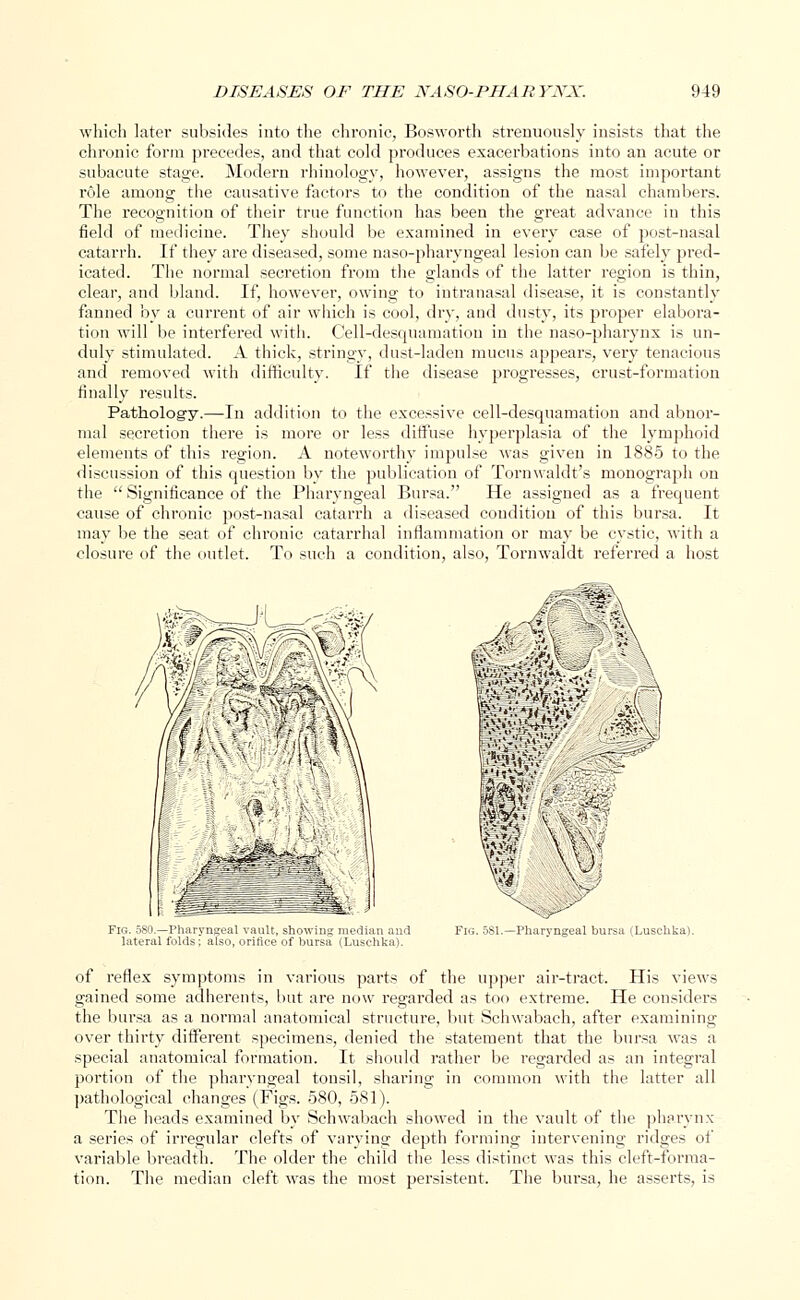 which later subsides into the chronic, Bosworth strenuously insists that the chronic form precedes, and that cold produces exacerbations into an acute or subacute stage. Modern rhinology, however, assigns the most important role among the causative factors to the condition of the nasal chambers. The recognition of their true function has been the great advance in this field of medicine. They should be examined in every case of post-nasal catarrh. If they are diseased, some naso-pharyngeal lesion can be safely pred- icated. The normal secretion from the glands of the latter region is thin, clear, and bland. If, however, owing to intranasal disease, it is constantly fanned by a current of air which is cool, dry, and dusty, its proper elabora- tion will be interfered with. Cell-desquamation in the naso-pharynx is un- duly stimulated. A thick, stringy, dust-laden mucus appears, very tenacious and removed with difficulty. If the disease progresses, crust-formation finally results. Patholog-y.—In addition to the excessive cell-desquamation and abnor- mal secretion there is more or less diffuse hyperplasia of the lymphoid elements of this region. A noteworthy impulse was given in 1885 to the discussion of this question by the publication of Tornwaldt's monograph on the  Significance of the Pharyngeal Bursa. He assigned as a frequent cause of chronic post-nasal catarrh a diseased condition of this bursa. It may be the seat of chronic catarrhal inflammation or may be cystic, with a closure of the outlet. To such a condition, also, Tornwaldt referred a host Fig. 580.—Pharyngeal vault, shov\in^ median and lateral folds; also, orifice of bursa (Luschka). eal bursa (Luschka). of reflex symptoms in various parts of the upper air-tract. His views gained some adherents, but are now regarded as too extreme. He considers the bursa as a normal anatomical structure, but Schwabach, after examining over thirty different specimens, denied the statement that the bursa was a special anatomical formation. It should rather be regarded as an integral portion of the pharyngeal tonsil, sharing in common with the latter all pathological changes (Figs. 580, 581). The heads examined by Schwabach showed in the vault of the pharynx a series of irregular clefts of varying depth forming intervening ridges of variable breadth. The older the child the less distinct was this cleft-forma- tion. The median cleft was the most persistent. The bursa, he asserts, is