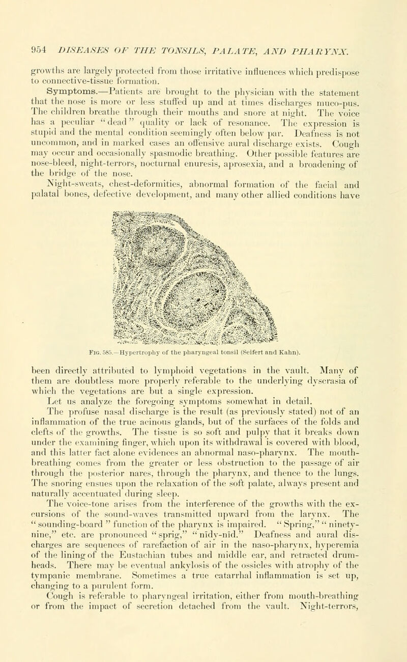 growths are largely protected from those irritative influences which predispose to connective-tissue formation. Symptoms.—Patients are brought to the physician with the statement that the nose is more or less stuffed up and at times discharges muco-pus. The children breathe through their mouths and snore at night. The voice has a peculiar dead quality or lack of resonance. The expression is stupid and the mental condition seemingly often below par. Deafness is not uncommon, and in marked cases an offensive aural discharge exists. Cough may occur and occasionally spasmodic breathing. Other possible features are nose-bleed, night-terrors, nocturnal enuresis, aprosexia, and a broadening of the bridge of tire nose. Night-sweats, chest-deformities, abnormal formation of the facial and palatal bones, defective development, and many other allied conditions have been directly attributed to lymphoid vegetations in the vault. Many of them are doubtless more properly referable to the underlying dyscrasia of which the vegetations are but a single expression. Let us analyze the foregoing symptoms somewhat in detail. The profuse nasal discharge is the result (as previously stated) not of an inflammation of the true acinous glands, but of the surfaces of the folds and clefts of the growths. The tissue is so soft and pulpy that it breaks down under the examining finger, which upon its withdrawal is covered with blood, and this latter fact alone evidences an abnormal naso-pharynx. The mouth- breathing comes from the greater or less obstruction to the passage of air through the posterior nares, through the pharynx, and thence to the lungs. The snoring ensues upon the relaxation of the soft palate, always present and naturally accentuated during sleep. The voice-tone arises from the interference of the growths with the ex- cursions of the sound-waves transmitted upward from the larynx. The  sounding-board  function of the pharynx is impaired.  Spring,  ninety- nine, etc. are pronounced sprig,  nldv-nid. Deafness and aural dis- charges are sequences of rarefaction of air in the naso-pharynx, hyperemia of the lining of the Eustachian tubes and middle ear, and retracted drum- heads. There may be eventual ankylosis of the ossicles with atrophy of the tympanic membrane. Sometimes a true catarrhal inflammation is set up, changing to a purulent form. Cough is referable to pharyngeal irritation, either from mouth-breathing or from the impact of secretion detached from the vault. Night-terrors,