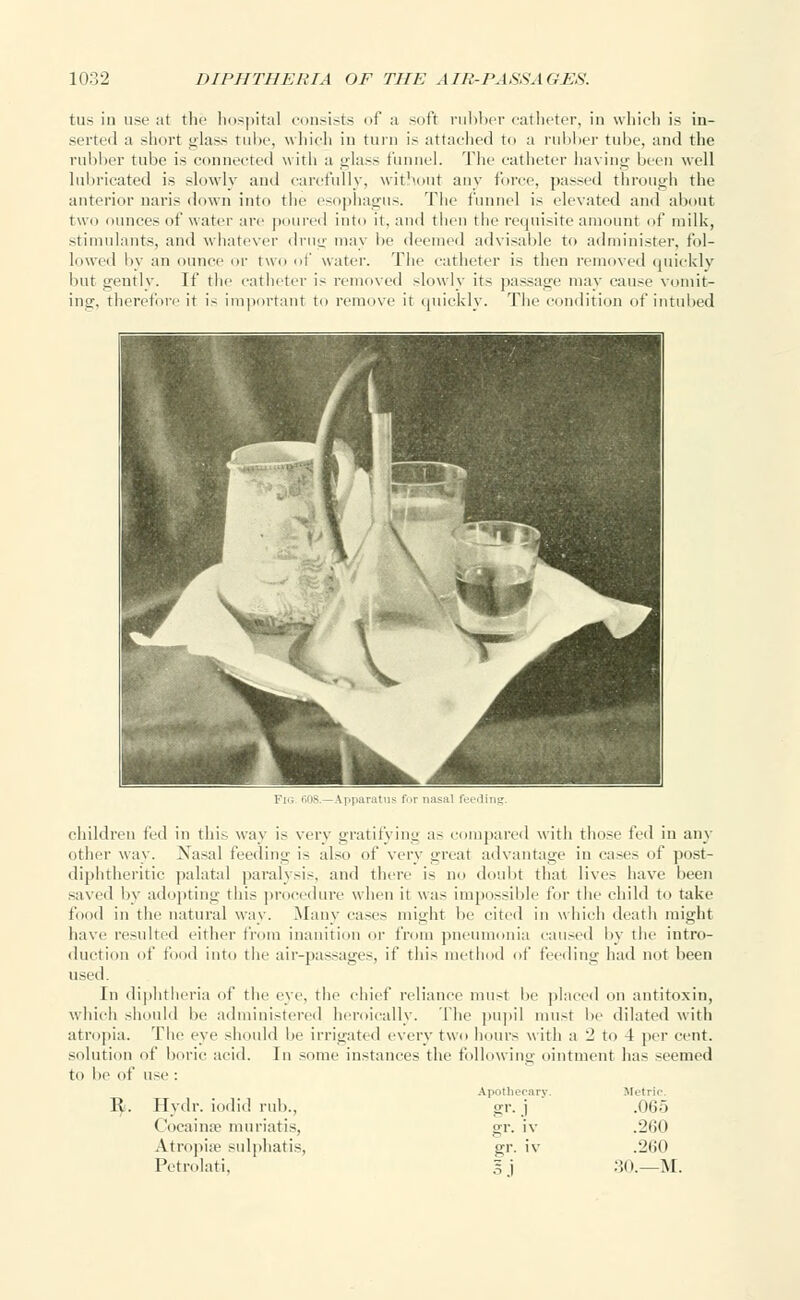 tus in use at the hospital consists of a soft rubber catheter, in which is in- serted a short glass tube, which in turn is attached to a rubber tube, and the rubber tube is connected with a glass funnel. The catheter having been well lubricated is slowly and carefully, without any force, passed through the anterior uaris down into the esophagus. The funnel is elevated and about two ounces of water arc poured into it. and then the requisite amount of milk, stimulants, and whatever drug may lie deemed advisable to administer, fol- lowed by an ounce or two of water. The catheter is then removed quickly but gently. If the catheter is removed slowly its passage may cause vomit- ing, therefore it is important to remove it quickly. The condition of in tubed children fed in this way is very gratifying as compared with those fed in any other way. Nasal feeding is also of very .real advantage in cases of post- diphtheritic palatal paralysis, and there is no doubt that lives have been saved by adopting this procedure when it was impossible for the child to take food in the natural way. .Many cases might be cited in which death might have resulted either from inanition or from pneumonia caused by the intro- duction of food into the air-passages, if this method of feeding had not been used. In diphtheria of the eye. the chief reliance must be placed on antitoxin, which should be administered heroically. The pupil rausl be dilated with atropia. The eye should be irrigated every two hours with a 2 to 4 per cent, solution of boric acid. In some instances the following ointment has seemed to be of use : Apothecary. Metric. ty. Hydr. iodid rub., gr. j .065 Cocainse muriatis, gr. iv .260 Atropia- sulphatis, gr. iv .260 Petrolati, gj 30.—M.