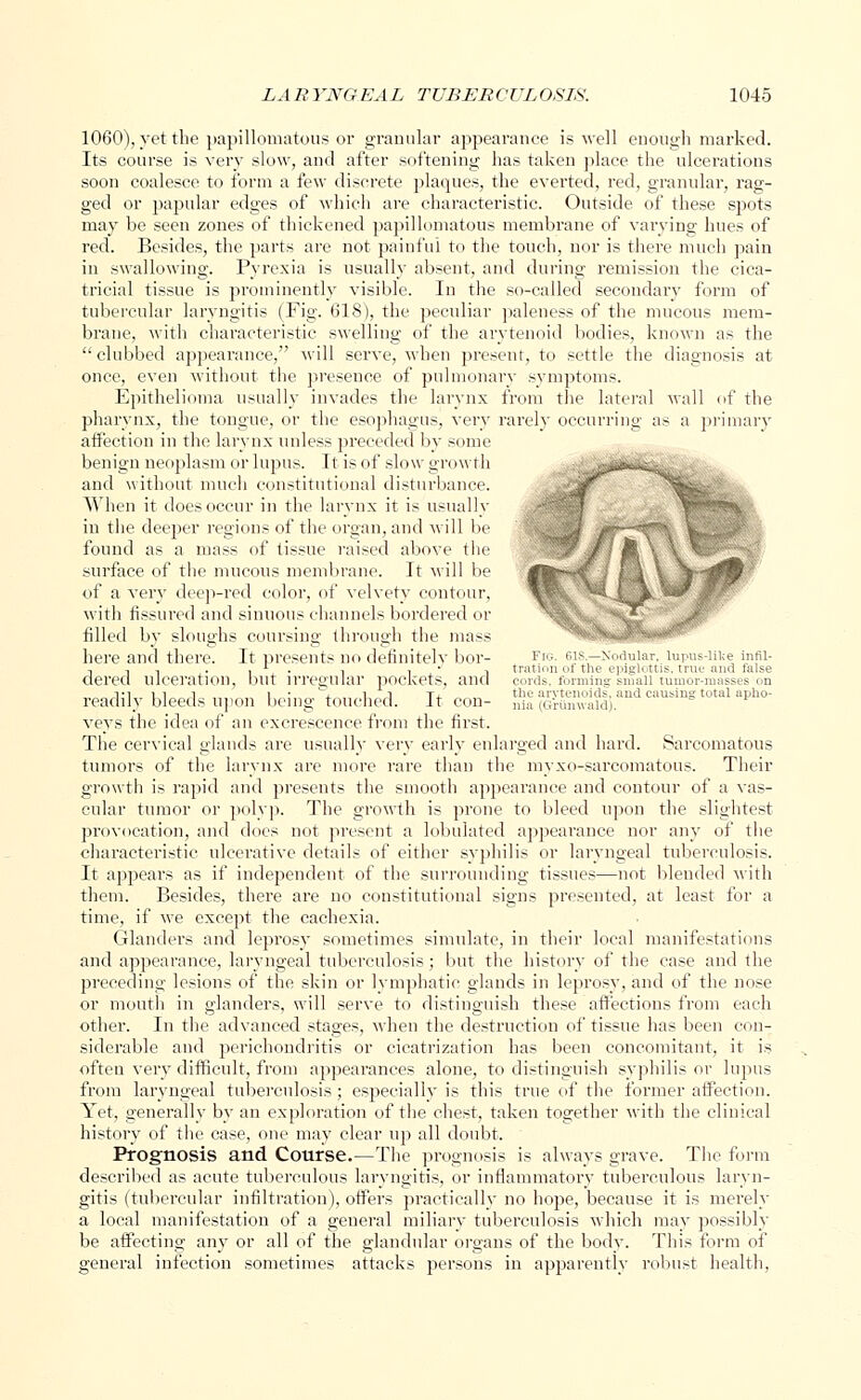 1060), yet the papillomatous or granular appearance is well enough marked. Its course is very slow, and after softening has taken place the ulcerations soon coalesce to form a few discrete plaques, the everted, red, granular, rag- ged or papular edges of which are characteristic. Outside of these spots may be seen zones of thickened papillomatous membrane of varying hues of red. Besides, the parts are not painful to the touch, nor is there much pain in swallowing. Pyrexia is usually absent, and during remission the cica- tricial tissue is prominently visible. In the so-called secondary form of tubercular laryngitis (Fig. 618), the peculiar paleness of the mucous mem- brane, with characteristic swelling of the arytenoid bodies, known as the clubbed appearance, will serve, when present, to settle the diagnosis at once, even without, the presence of pulmonary symptoms. Epithelioma usually invades the larynx from the lateral wall of the pharynx, the tongue, or the esophagus, very rarely occurring as a primary affection in the larynx unless preceded by some benign neoplasm or lupus. It is of slow growth and without much constitutional disturbance. When it does occur in the larynx it is usually in the deeper regions of the organ, and will be found as a mass of tissue raised above the r J p surface of the mucous membrane. It will be flt<x of a very deep-red color, of velvety contour, with fissured and sinuous channels bordered or filled by sloughs coursing through the mass here and there. It presents no definitely bor- Fro. 6is.—Nodular, lupus-like mi- -. -. . . . l , , , tration ot the epiglottis, true and talse dered Ulceration, but irregular pockets, and cords, forming small tuinor-masses on vi i 7 i i ■ „. , t J Tx the arytenoid;-, and cam-in^ total apho- readily bleeds upon being touched. It con- nia (Grumvaid). veys the idea of an excrescence from the first. The cervical glands are usually very early enlarged and hard. Sarcomatous tumors of the larynx are more rare than the myxo-sarcomatous. Their growth is rapid and presents the smooth appearance and contour of a vas- cular tumor or polyp. The growth is prone to bleed upon the slightest provocation, and does not present a lobulated appearance nor any of the characteristic ulcerative details of either syphilis or laryngeal tuberculosis. It appears as if independent of the surrounding tissues—not blended with them. Besides, there are no constitutional signs presented, at least for a time, if we except the cachexia. Glanders and leprosy sometimes simulate, in their local manifestations and appearance, laryngeal tuberculosis; but the history of the ease and the preceding lesions of the skin or lymphatic glands in leprosy, and of the nose or mouth in glanders, will serve to distinguish these affections from each other. In the advanced stages, when the destruction of tissue has been con- siderable and perichondritis or cicatrization has been concomitant, it is often very difficult, from appearances alone, to distinguish syphilis or lupus from laryngeal tuberculosis; especially is this true of the former affection. Yet, generally by an exploration of the chest, taken together with the clinical history of the case, one may clear up all doubt. Prognosis and Course.—The prognosis is always grave. The form described as acute tuberculous laryngitis, or inflammatory tuberculous laryn- gitis (tubercular infiltration), offers practically no hope, because it is merely a local manifestation of a general miliary tuberculosis which may possibly be affecting any or all of the glandular organs of the body. This form of general infection sometimes attacks persons in apparently robust health,