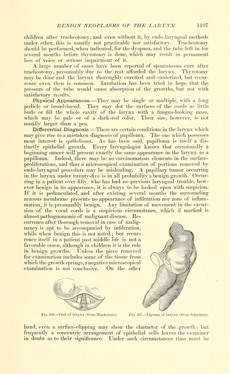 children after tracheotomy, and even without it, by endo-laryngeal methods under ether, this is usually not practicable nor satisfactory. Tracheotomy should be performed, when indicated, for the dyspnea, and the tube left in for several months before thyrotomy is done, which may result in permanent loss of voice or serious impairment of it. A large number of cases have been reported of spontaneous cure after tracheotomy, presumably due to the rest afforded the larynx. Thyrotomy may be done and the larynx thoroughly curetted and cauterized, but recur- rence even then is common. Intubation has been tried in hope that the pressure of the tube would cause absorption of the growths, but not with satisfactory results. Physical Appearances.—They may be single or multiple, with a long pedicle or broad-based. They may dot the surfaces of the cords as little buds or fill the whole cavity of the larynx with a fungus-looking mass, which may be pale or of a dark-red color. Their size, however, is not usually larger than a pea. Differential Diagnosis.—There are certain conditions in the larynx which may give rise to a mistaken diagnosis of papilloma. The one which possesses most interest is epithelioma. As has been said, papilloma is itself a dis- tinctly epithelial growth. Every laryngologist knows that occasionally a beginning cancer will present exactly the same appearance in the larynx as a papilloma. Indeed, there may be no carcinomatous elements in the surface- proliferations, and thus a microscopical examination of portions removed by endo-laryngeal procedure may be misleading. A papillary tumor occurring in the larynx under twenty-five is in all probability a benign growth. Occur- ring in a patient over fifty, who has had no previous laryngeal trouble, how- ever benign in its appearance, it is always to be looked upon with suspicion. If it is pedunculated, and after existing several months the surrounding mucous membrane presents no appearance of infiltration nor zone of inflam- mation, it is presumably benign. Any limitation of movement in the excur- sion of the vocal cords is a suspicious circumstance, which if marked is almost pathognomonic of malignant disease. Re- currence after thorough removal in case of malig- nancy is apt to be accompanied by infiltration, while when benign this is not noted ; but recur- rence itself in a patient past middle life is not a favorable omen, although in children it is the rule in benign growths. Unless the piece removed for examination includes some of the tissue from which the growth springs, a negative microscopical examination is not conclusive. On the other Fig. 636.—Cyst of larynx (from Mackenzie). Fig. 637.—Lipoma of larynx (from Schrotter). hand, even a surface-clipping may show the character of the growth ; but frequently a concentric arrangement of epithelial cells leaves the examiner in doubt as to their significance. Under such circumstances time must be