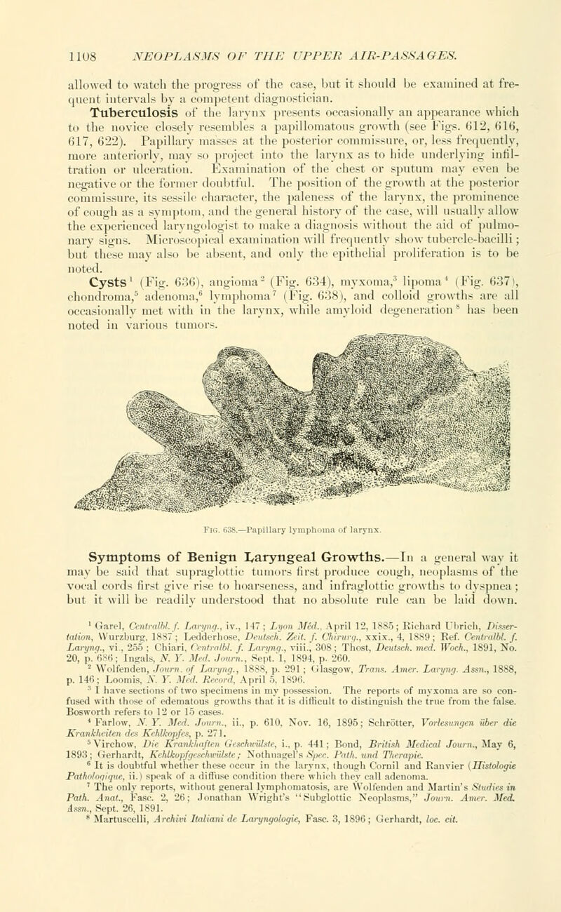 allowed to watch the progress of the case, but it should be examined at fre- quent intervals by a competent diagnostician. Tuberculosis of the larynx presents occasionally an appearance which to the novice closely resembles a papillomatous growth (see Figs. 612, (ill!, (117, i>2'2). Papillary masses at the posterior commissure, or, less frequently, more anteriorly, may so project into the larynx as to hide underlying infil- tration or ulceration. Examination of the chest or sputum may even be negative or the former doubtful. The position of the growth at the posterior commissure, its sessile character, the paleness of the larynx, the prominence of cough as a symptom, and the general history of the case, will usually allow the experienced laryngologist to make a diagnosis without the aid of pulmo- nary signs. Microscopical examination will frequently show tubercle-bacilli; but these may also be absent, and only the epithelial proliferation is to be noted. Cysts' (Fig. 636), angioma2 (Fig. 634), myxoma,'* lipoma4 (Fig. 637 , chondroma/ adenoma,6 lymphoma7 (Fig. 638), and colloid growths are all occasionally met with in the larynx, while amyloid degeneration8 has been noted in various tumor-. ii Fig. G3S.—Papillary lymphoma of larynx. Symptoms of Benign laryngeal Growths.—In a general way it may be said that supraglottis' tumors first produce cough, neoplasms of the vocal cords first give rise to hoarseness, and infraglottic growths to dyspnea ; but it will be readily understood that no absolute rule can be laid down. 1 Garel, Ceniratbl. f. Laryng., iv., 147; L<i<m Med., April 12, 1885; Richard Ubrich, Disser- tation, VVurzburg, lss;'; Ledderhose, Deutsch. Zeit. f. Chirurg., xxix., 4. 1889; Ret'. Centralbl. f. Laryng., vi . 255; Cbiari, Centralbl. f. Laryng., viii., 308; Thost, Deutsch. med. Woch., 1891, No. 20, p. 686; Ingals, .V. 1'. Med. Jowrn., Sept. 1. 1894, p. 260. '-' Wolfenden, .[mini. <>f Laryng., 1888, p. 291 ; (ilasgow. Trans. Amer. Laryng. Assn., 1888, p. 146; Loomis. .V. )'. Med. Record, April 5. 1S96. 3 I have sections of two specimens in my possession. The reports of myxoma are so con- fused with those of edematous growths that it is difficult to distinguish the true from the false. Bosworth refers to 12 or 15 cases. 4 Farlow, .V. 1. Med. Journ., ii., p. 610. Nov. 16, 1895; Schrotter, Vorlesungen Uber die Krankheilen des KehUcopfes, p. 271. 5Virchow, Die Kranlchaften GeschwiHste, i.. p. 441; Bond, British Medical Journ., May 6, 1893; Gerhardt, Kehlkupfyiwliiriitstr; Nothnagel's Spec. Path, and Therapie, 6 It is doubtful whether these occur in the larynx, (hough Cornil and Ranvier (Histologic Pathol ngiqne, ii.) speak of a diffuse condition there which they call adenoma. ' The only reports, without general lymphomatosis, are Wolfenden and Martin'-; Studies in Path. Anal.. Fasc. 2, 26; Jonathan Wrights Subglottic Neoplasms, Journ. Amer. Med, ism., Sept. 26, 1891. 8 Martuscelli, Archiri Italianide Laryngologie, Fasc. 3, 1S96; Gerhardt, loc. cit.