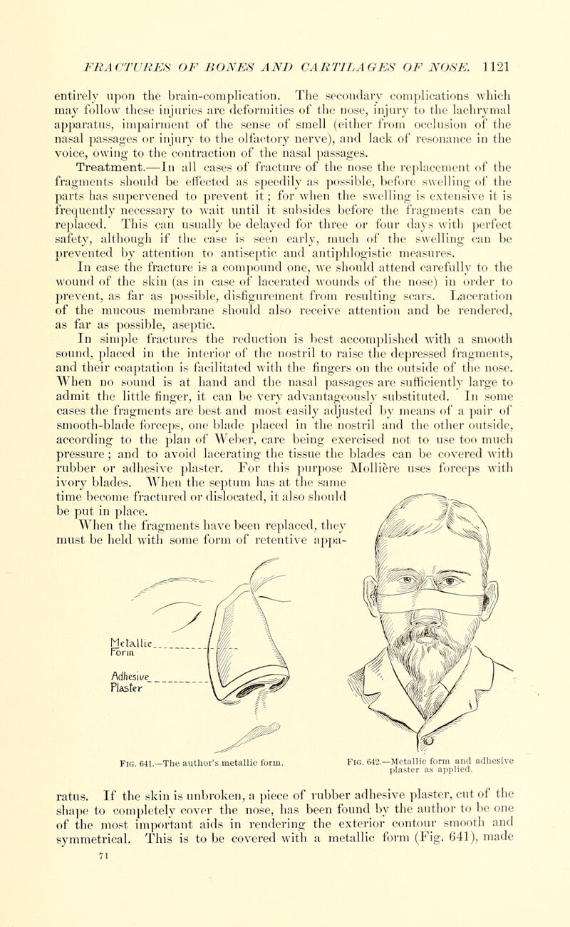 entirely upon the brain-complication. The secondary complications which may follow these injuries are deformities of the nose, injury to the lachrymal apparatus, impairment of the sense of smell (either from occlusion of the nasal passages or injury to the olfactory nerve), and lack of resonance in the voice, owing to the contraction of the nasal passages. Treatment.—In all cases of fracture of the nose the replacement of the fragments should be effected as speedily as possible, before swelling of the parts has supervened to prevent it; for when the swelling is extensive it is frequently necessary to wait until it subsides before the fragments can be replaced. This can usually be delayed for three or four days with perfect safety, although if the case is seen early, much of the swelling can be prevented by attention to antiseptic and antiphlogistic measures. In case the fracture is a compound one, we should attend carefully to the wound of the skin (as in case of lacerated wounds of the nose) in order to prevent, as far as possible, disfigurement from resulting scars. Laceration of the mucous membrane should also receive attention and be rendered, as far as possible, aseptic. In simple fractures the reduction is best accomplished with a smooth sound, placed in the interior of the nostril to raise the depressed fragments, and their coaptation is facilitated with the fingers on the outside of the nose. When no sound is at hand and the nasal passages are sufficiently large to admit the little finger, it can be very advantageously substituted. In some cases the fragments are best and most easily adjusted by means of a pair of smooth-blade forceps, one blade placed in the nostril and the other outside, according to the plan of Weber, care being exercised not to use too much pressure; and to avoid lacerating the tissue the blades can be covered with rubber or adhesive plaster. For this purpose Molliere uses forceps with ivory blades. When the septum has at the same time become fractured or dislocated, it also should be put in place. JT iL When the fragments have been replaced, they iiilk^*^' must be held with some form of retentive appa- Fig. 641.—The author's metallic form. Fig. 642.—Metallic form and adhesive plaster as applied. ratus. If the skin is unbroken, a piece of rubber adhesive plaster, cut of the shape to completely cover the nose, has been found by the author to be one of the most important aids in rendering the exterior contour smooth and symmetrical. This is to be covered with a metallic form (Fig. 641), made