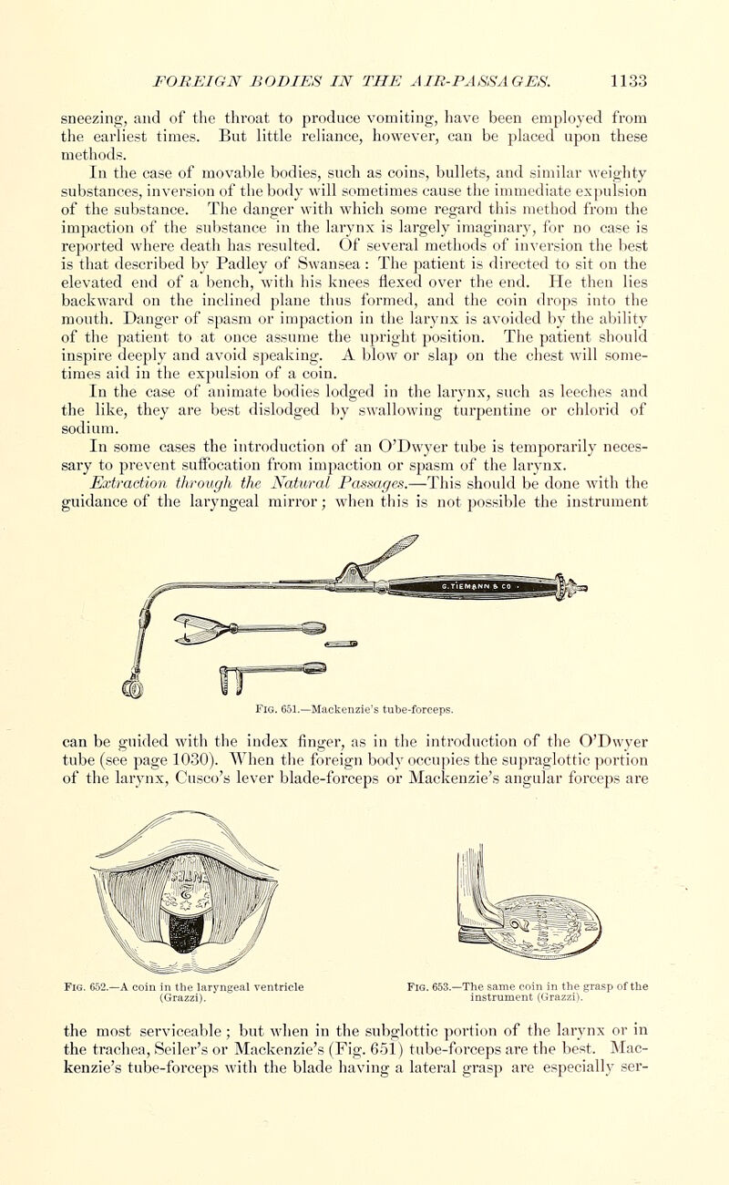 sneezing, and of the throat to produce vomiting, have been employed from the earliest times. But little reliance, however, can be placed upon these methods. In the case of movable bodies, such as coins, bullets, and similar weighty substances, inversion of the body will sometimes cause the immediate expulsion of the substance. The danger with which some regard this method from the impaction of the substance in the larynx is largely imaginary, for no case is reported where death has resulted. Of several methods of inversion the best is that described by Padley of Swansea : The patient is directed to sit on the elevated end of a bench, with his knees flexed over the end. He then lies backward on the inclined plane thus formed, and the coin drops into the mouth. Danger of spasm or impaction in the larynx is avoided by the ability of the patient to at once assume the upright position. The patient should inspire deeply and avoid speaking. A blow or slap on the chest will some- times aid in the expulsion of a coin. In the case of animate bodies lodged in the larynx, such as leeches and the like, they are best dislodged by swallowing turpentine or chlorid of sodium. In some cases the introduction of an O'Dwyer tube is temporarily neces- sary to prevent suffocation from impaction or spasm of the larynx. Extraction through the Natural Passages.—This should be done with the guidance of the laryngeal mirror; when this is not possible the instrument Fig. 651.—Mackenzie's tube-forceps. can be guided with the index finger, as in the introduction of the O'Dwyer tube (see page 1030). When the foreign body occupies the supraglottic portion of the larynx, disco's lever blade-forceps or Mackenzie's angular forceps are Fig. 652.—A coin in the laryngeal ventricle (Grazzi). Fig. 653.—The same coin in the grasp of the instrument (Grazzi). the most serviceable ; but when in the subglottic portion of the larynx or in the trachea, Seiler's or Mackenzie's (Fig. 651) tube-forceps are the best. Mac- kenzie's tube-forceps with the blade having a lateral grasp are especially ser-