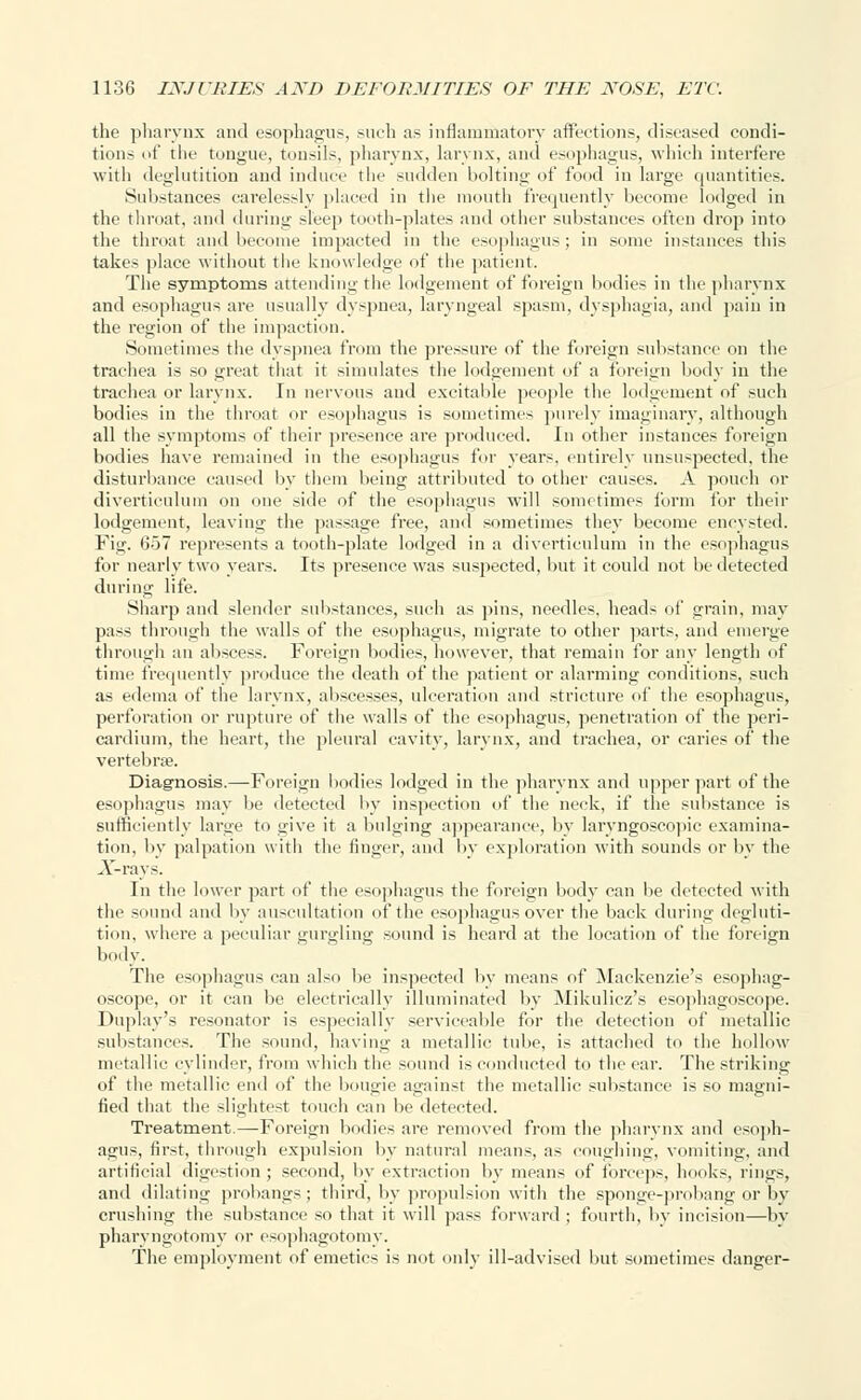 the pharynx and esophagus, such as inflammatory affections, diseased condi- tions of the tongue, tonsils, pharynx, larynx, and esophagus, which interfere with deglutition and induce the sudden bolting of fund in large quantities. Substances carelessly placed in the mouth frequently become lodged in the throat, and during sleep tooth-plates and other substances often drop into the throat and become impacted in the esophagus; in some instances this takes place without the knowledge of the patient. The symptoms attending the lodgement of foreign bodies in the pharynx and esophagus are usually dyspnea, laryngeal spasm, dysphagia, and pain in the region of the impaction. Sometimes the dyspnea from the pressure of the foreign substance on the trachea is so great that it simulates the lodgement of a foreign body in the trachea or larynx. In nervous and excitable people the lodgement of such bodies in the throat or esophagus is sometimes purely imaginary, although all the symptoms of their presence are produced. In other instances foreign bodies have remained in the esophagus for years, entirely unsuspected, the disturbance caused by them being attributed to other causes. A pouch or diverticulum on one side of the esophagus will sometimes form for their lodgement, leaving the passage free, and sometimes they become encysted. Fig. <>->7 represents a tooth-plate lodged in a diverticulum in the esophagus for nearly two years. Its presence was suspected, but it could not be detected during life. Sharp and slender substances, such as pins, needles, heads of grain, may pass through the walls of the esophagus, migrate to other parts, and emerge through an abscess. Foreign bodies, however, that remain for any length of time frequently produce the death of the patient or alarming conditions, such as edema of the larynx, abscesses, ulceration and stricture of the esophagus, perforation or rupture of the walls of the esophagus, penetration of the peri- cardium, the heart, the pleural cavity, larynx, and trachea, or caries of the vertebrae. Diagnosis.—Foreign bodies lodged in the pharynx and upper part of the esophagus may be detected by inspection of the neck, if the substance is sufficiently large to give it a bulging appearance, by larvngoscopic examina- tion, by palpation with the finger, and by exploration with sounds or by the Arrays. In the lower part of the esophagus the foreign body can be detected with the sound and by auscultation of the esophagus over the back during degluti- tion, where a peculiar gurgling sound is heard at the location of the foreign body. The esophagus can also be inspected by means of Mackenzie's esophag- oscope, or it can be electrically illuminated by Mikulicz's esophagoscope. Duplay's resonator is especially serviceable for the detection of metallic substances. The sound, having a metallic tube, is attached to the hollow metallic cylinder, from which the sound is conducted to the car. The striking of the metallic end of the bougie against the metallic substance is so magni- fied that the slightest touch can lie detected. Treatment.—Foreign bodies are removed from the pharynx and esoph- agus, first, through expulsion by natural means, as coughing, vomiting, and artificial digestion; second, by extraction by means of forceps, luniks, lines, and dilating probangs ; third, by propulsion with the sponge-prohang or by crushing the substance so that it will pass forward ; fourth, by incision—by pharvngotomy or esophagotomv. The employment of emetics is not only ill-advised but sometimes danger-