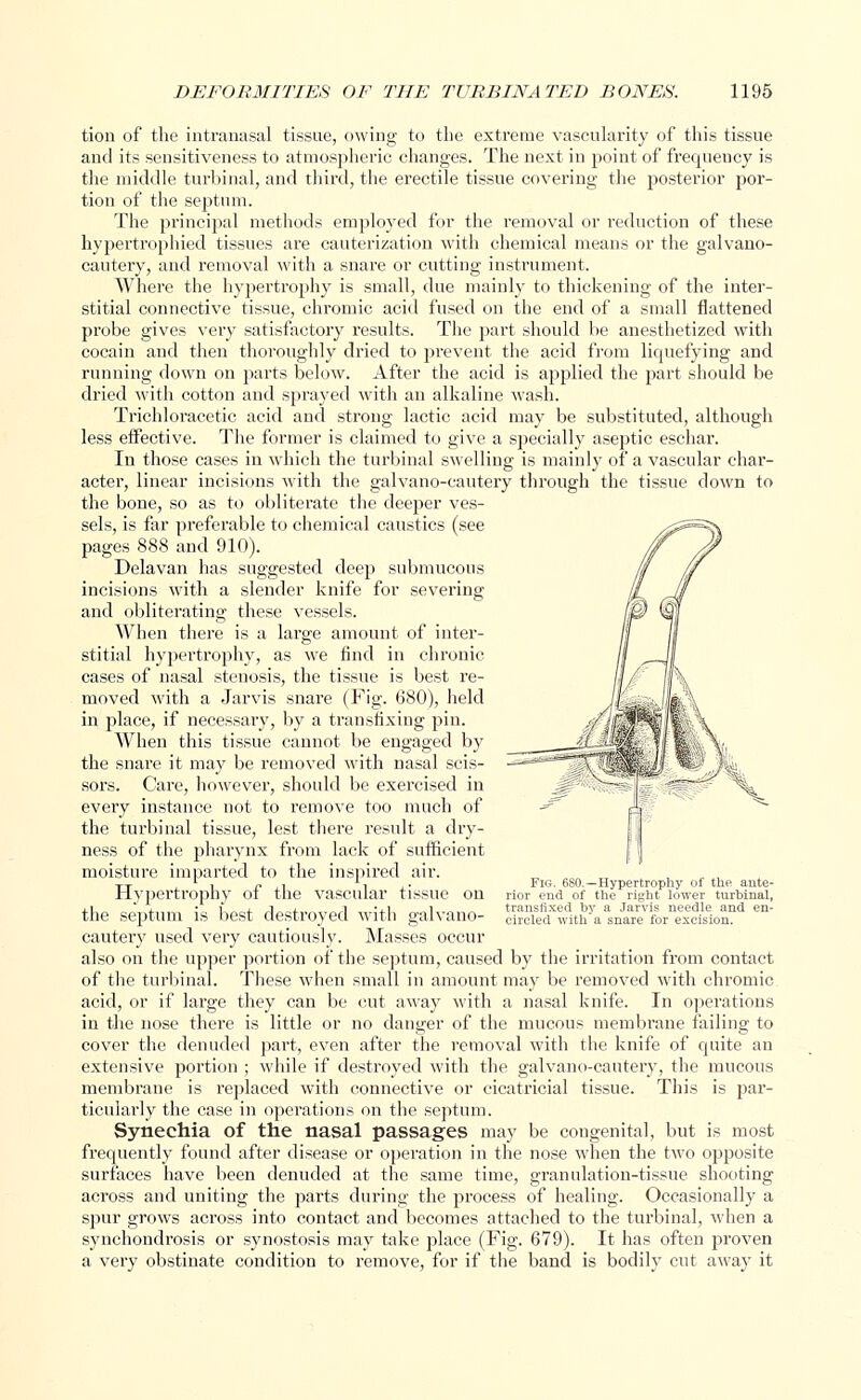 tion of the intranasal tissue, owing to the extreme vascularity of this tissue and its sensitiveness to atmospheric changes. The next in point of frequeucy is the middle turbinal, and third, the erectile tissue covering the posterior por- tion of the septum. The principal methods employed for the removal or reduction of these hypertrophied tissues are cauterization with chemical means or the galvano- cautery, and removal with a snare or cutting instrument. Where the hypertrophy is small, due mainly to thickening of the inter- stitial connective tissue, chromic acid fused on the end of a small flattened probe gives very satisfactory results. The part should be anesthetized with cocain and then thoroughly dried to prevent the acid from liquefying and running down on parts below. After the acid is applied the part should be dried with cotton and sprayed with an alkaline wash. Trichloracetic acid and strong lactic acid may be substituted, although less effective. The former is claimed to give a specially aseptic eschar. In those cases in which the turbinal swelling is mainly of a vascular char- acter, linear incisions with the galvano-cautery through the tissue down to the bone, so as to obliterate the deeper ves- sels, is far preferable to chemical caustics (see pages 888 and 910). Delavan has suggested deep submucous incisions with a slender knife for severing and obliterating these vessels. When there is a large amount of inter- stitial hypertrophy, as we find in chronic cases of nasal stenosis, the tissue is best re- moved with a Jarvis snare (Fig. 680), held in place, if necessary, by a transfixing pin. When this tissue cannot be engaged by the snare it may be removed with nasal scis- sors. Care, however, should be exercised in every instance not to remove too much of the turbinal tissue, lest there result a dry- ness of the pharynx from lack of sufficient moisture imparted to the inspired air. Hypertrophy of the vascular tissue on the septum is best destroyed with galvano- cautery used very cautiously. Masses occur also on the upper portion of the septum, caused by the irritation from contact of the turbinal. These when small in amount may be removed with chromic acid, or if large they can be cut away with a nasal knife. In operations in the nose there is little or no danger of the mucous membrane failing to cover the denuded part, even after the removal with the knife of quite an extensive portion ; while if destroyed with the galvano-cautery, the mucous membrane is replaced with connective or cicatricial tissue. This is par- ticularly the case in operations on the septum. Synechia of the nasal passages may be congenital, but is most frequently found after disease or operation in the nose when the two opposite surfaces have been denuded at the same time, granulation-tissue shooting across and uniting the parts during the process of healing. Occasionally a spur grows across into contact and becomes attached to the turbinal, when a synchondrosis or synostosis may take place (Fig. 679). It has often proven a very obstinate condition to remove, for if the band is bodily cut away it Fig. 6S0. —Hypertrophy of the ante- rior end of the right lower turhinal, transfixed by a Jarvis needle and en- circled with a snare for excision.