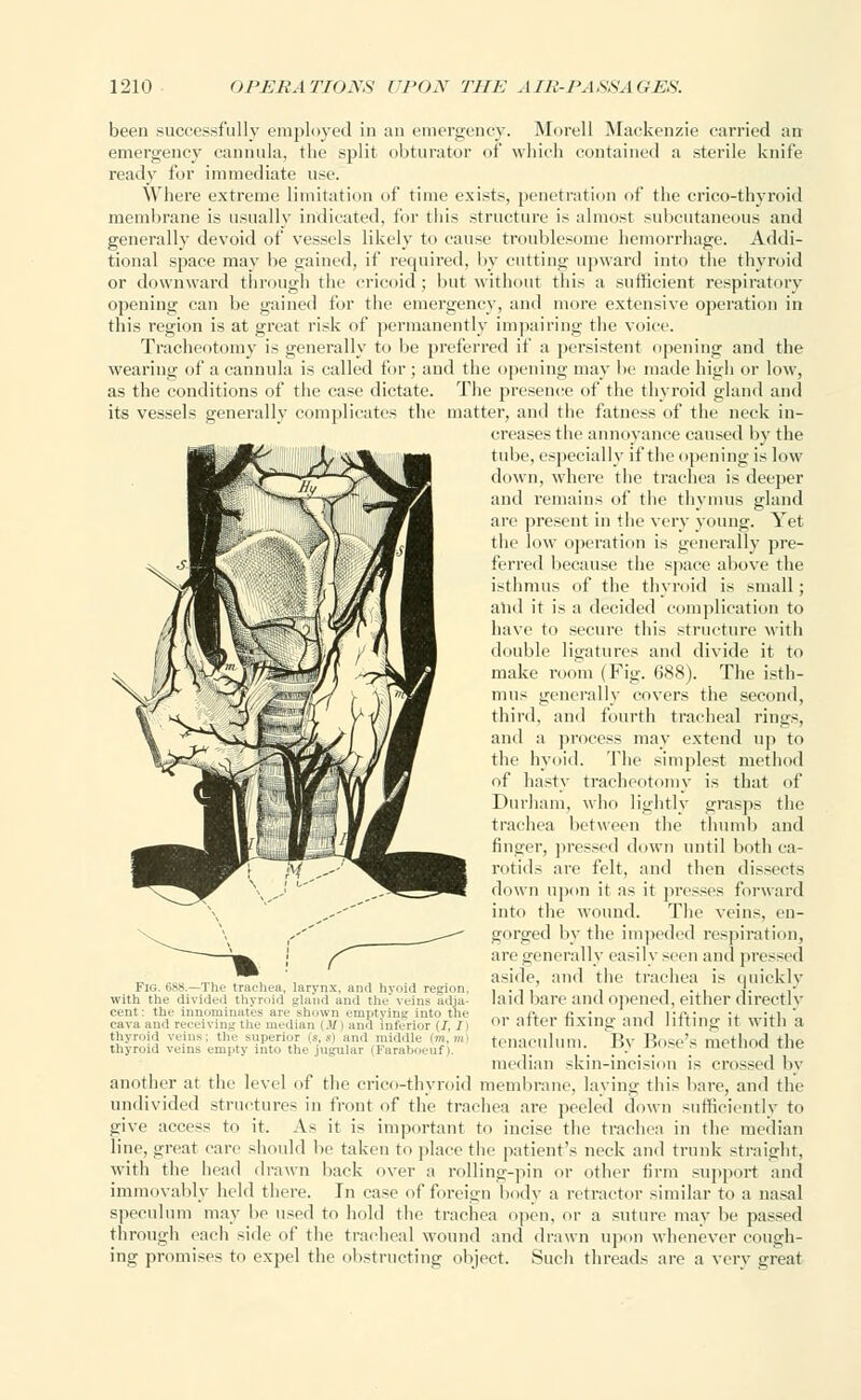 been successfully employed in an emergency. Morell Mackenzie carried an emergency cannula, the split obturator of which contained a sterile knife ready for immediate use. Where extreme limitation of time exist;-, penetration of the crico-thyroid membrane is usually indicated, for this structure is almost subcutaneous and generally devoid of vessels likely to cause troublesome hemorrhage. Addi- tional space may be gained, if required, by cutting upward into the thyroid or downward through the cricoid; but without this a sufficient respiratory opening can be gained for the emergency, and more extensive operation in this region is at great risk of permanently impairing the voice. Tracheotomy is generally to be preferred if a persistent opening and the wearing of a cannula is called for; and the opening may be made high or low, as the conditions of the case dictate. The presence of the thyroid gland and its vessels generally complicates the matter, ami the fatness of the neck in- creases the annoyance caused by the tube, especially if the opening is low down, where the trachea is deeper and remains of the thymus gland are present in the very young. Yet the low operation is generally pre- ferred because the space above the isthmus of the thyroid is small; and it is a decided complication to have to secure this structure with double ligatures and divide it to make room (Fig. 688). The istli- mus generally covers the second, third, and fourth tracheal rings, and a process may extend up to the hyoid. The simplest method of hasty tracheotomy is that of Durham, who lightly grasps the trachea between the thumb and finder, pressed down until both ca- rotids ;irc felt, and then dissects down upon it as it presses forward into the wound. The veins, en- gorged by the impeded respiration, are generally easily seen and pressed aside, and the trachea is quickly laid bare and opened, either directly or after fixing and lifting it with a tenaculum. By Bose's method the median skin-incision is crossed by another at the level of the crico-thyroid membrane, laying this bare, and the undivided structures in front of the trachea are peeled down sufficiently to give access to it. As it is important to incise the trachea in the median line, great care should lie taken to place the patient's neck and trunk straight, with the head drawn back over a rolling-pin or other firm support and immovably held there. In case of foreign body a retractor similar to a nasal speculum may be used to bold the trachea open, or a suture may be passed through each side of the tracheal wound and drawn upon whenever cough- ing promises to expel the obstructing object. Such threads are a very great Fig. 6S8.—The trachea, larynx with the divided thyroid gland ; cent: tin- innominates aiv -In.wn cava and receiving the median {M thyroid veins; tin/ superior (s, lyoid region. e veins adja- jmg nit tin' inferior (J, / [riddle thyroid veins empty into the jugular (Faraboeuf).