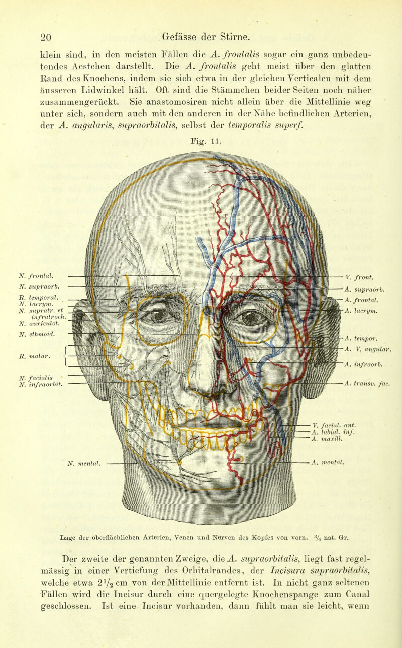 klein sind, in den meisten Fällen die A. frontalis sogar ein ganz unbedeu- tendes Aestchen darstellt. Die A. frontalis geht meist über den glatten Rand des Knochens, indem sie sich etwa in der gleichen Yerticalen mit dem äusseren Lidwinkel hält. Oft sind die Stämmchen beider Seiten noch näher zusammengerückt. Sie anastomosiren nicht allein über die Mittellinie weg unter sich, sondern auch mit den anderen in der Nähe befindlichen Arterien, der A. angularis, supraorbitalis, selbst der temporalis superf. Fig. 11. N. facialis N. infraorbit A. tempor. A. V. angitlar. A. infraorb. A. transv. fac. N. mental. V. faciah ant. A. labial, inf. A maxill. A. mental. Lage der oberflächlichen Arterien, Venen und Nerven des Kopfes von vorn. % nat. Gr. Der zweite der genannten Zweige, die A. supraorbitalis, liegt fast regel- mässig in einer Vertiefung des Orbitalrandes, der Incisura supraorbitalis, welche etwa 2l/2 cm von der Mittellinie entfernt ist. In nicht ganz seltenen Fällen wird die Incisur durch eine quergelegte Knochenspange zum Canal geschlossen. Ist eine Incisur vorhanden, dann fühlt man sie leicht, wenn