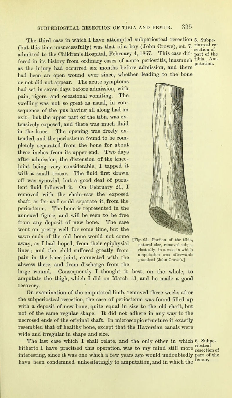 The third case in which I have attempted subperiosteal resection (but this time unsuccessfully) was that of a boy (John Crowe), set. 7, admitted to the Children's Hospital, February 4,1867. This case dif- fered in its history from ordinary cases of acute periostitis, inasmuch as the injury had occurred six months before admission, and there had been an open wound ever since, whether leading to the bone or not did not appear. The acute symptoms had set in seven days before admission, with pain, rigors, and occasional vomiting. The swelling was not so great as usual, in con- sequence of the pus having all along had an exit; but the upper part of the tibia was ex- tensively exposed, and there was much fluid in the knee. The opening was freely ex- tended, and the periosteum found to be com- pletely separated from the bone for about three inches from its upper end. Two days after admission, the distension of the knee- joint being very considerable, I tapped it with a small trocar. The fluid first drawn off was synovial, but a good deal of puru- lent fluid followed it. On February 21, I removed with the chain-saw the exposed shaft, as far as I could separate it, from the periosteum. The bone is represented in the annexed figure, and will be seen to be free from any deposit of new bone. The case went on pretty well for some time, but the sawn ends of the old bone would not come away, as I had hoped, from their epiphysial lines; and the child suffered greatly from pain in the knee-joint, connected with the abscess there, and from discharge from the large wound. Consequently I thought it best, on the whole, to amputate the thigh, which I did on March 13, and he made a good recovery. On examination of the amputated limb, removed three weeks after the subperiosteal resection, the case of periosteum was found filled up with a deposit of new bone, quite equal in size to the old shaft, but not of the same regular shape. It did not adhere in any way to the necrosed ends of the original shaft. In microscopic structure it exactly resembled that of healthy bone, except that the Haversian canals were wide and irregular in shape and size. The last case which I shall relate, and the only other in which hitherto I have practised this operation, was to my mind still more interesting, since it was one which a few years ago would undoubtedly have been condemned unhesitatingly to amputation, and in which the 5. Subpe- riosteal re- section of part of the tibia. Am- putation. [Fig. 63. Portion of the tibia, natural size, removed subpe- riosteally, in a case in which amputation was afterwards practised (John Crowe).] 6. Subpe- riosteal resection of part of the femur.