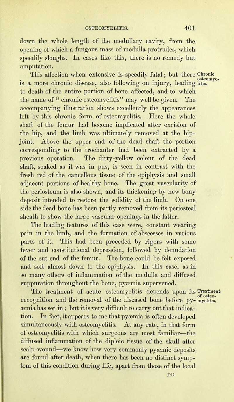 down the whole length of the medullary cavity, from the opening of which a fungons mass of medulla protrudes, which speedily sloughs. In cases like this, there is no remedy but amputation. This affection when extensive is speedily fatal; but there Chronic is a more chronic disease, also following on injury, leading litis, to death of the entire portion of bone affected, and to which the name of  chronic osteomyelitis may well be given. The accompanying illustration shows excellently the appearances left by this chronic form of osteomyelitis. Here the whole shaft of the femur had become implicated after excision of the hip, and the limb was ultimately removed at the hip- joint. Above the upper end of the dead shaft the portion corresponding to the trochanter had been extracted by a previous operation. The dirty-yellow colour of the dead shaft, soaked as it was in pus, is seen in contrast with the fresh red of the cancellous tissue of the epiphysis and small adjacent portions of healthy bone. The great vascularity of the periosteum is also shown, and its thickening by new bony deposit intended to restore the solidity of the limb. On one side the dead bone has been partly removed from its periosteal sheath to show the large vascular openings in the latter. The leading features of this case were, constant wearing pain in the limb, and the formation of abscesses in various parts of it. This had been preceded by rigors with some fever and constitutional depression, followed by denudation of the cut end of the femur. The bone could be felt exposed and soft almost down to the epiphysis. In this case, as in so many others of inflammation of the medulla and diffused suppuration throughout the bone, pysemia supervened. The treatment of acute osteomyelitis depends upon its Treatment recognition and the removal of the diseased bone before py- myelitis, semia has set in; but it is very difficult to carry out that indica- tion. In fact, it appears to me that pyaemia is often developed simultaneously with osteomyelitis. At any rate, in that form of osteomyelitis with which surgeons are most familiar—the diffused inflammation of the diploic tissue of the skull after scalp-wound—we know how very commonly pysemic deposits are found after death, when there has been no distinct symp- tom of this condition during life, apart from those of the local DD