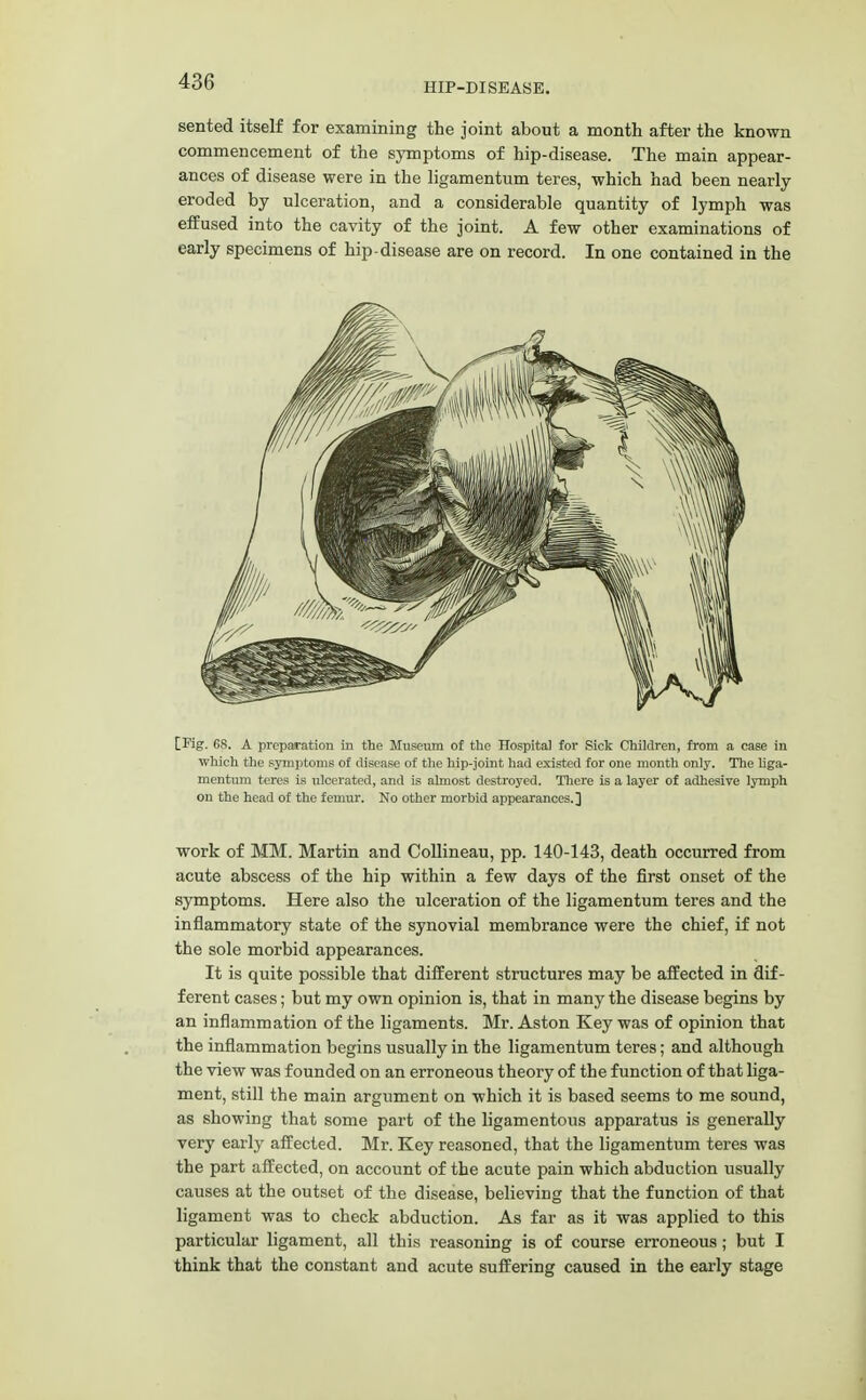 HIP-DISEASE. sented itself for examining the joint about a month after the known commencement of the symptoms of hip-disease. The main appear- ances of disease were in the ligamentum teres, which had been nearly eroded by ulceration, and a considerable quantity of lymph was effused into the cavity of the joint. A few other examinations of early specimens of hip-disease are on record. In one contained in the [Pig. GS. A preparation in the Museum of the Hospital for Sick Children, from a case in which the symptoms of disease of the hip-joint had existed for one month only. The liga- mentum teres is ulcerated, and is almost destroyed. There is a layer of adhesive lymph on the head of the femur. No other morbid appearances.] work of MM. Martin and Collineau, pp. 140-143, death occurred from acute abscess of the hip within a few days of the first onset of the symptoms. Here also the ulceration of the ligamentum teres and the inflammatory state of the synovial membrance were the chief, if not the sole morbid appearances. It is quite possible that different structures may be affected in dif- ferent cases; but my own opinion is, that in many the disease begins by an inflammation of the ligaments. Mr. Aston Key was of opinion that the inflammation begins usually in the ligamentum teres; and although the view was founded on an erroneous theory of the function of that liga- ment, still the main argument on which it is based seems to me sound, as showing that some part of the ligamentous apparatus is generally very early affected. Mr. Key reasoned, that the ligamentum teres was the part affected, on account of the acute pain which abduction usually causes at the outset of the disease, believing that the function of that ligament was to check abduction. As far as it was applied to this particular ligament, all this reasoning is of course erroneous; but I think that the constant and acute suffering caused in the early stage