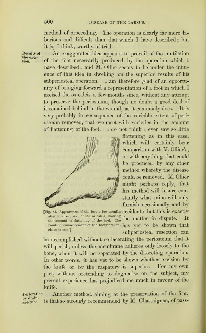 method of proceeding. The operation is clearly far more la- borious and difficult than that which I have described; but it is, I think, worthy of trial. Results of An exaggerated idea appears to prevail of the mutilation sion. of the foot necessarily produced by the operation which I have described; and M. Oilier seems to be under the influ- ence of this idea in dwelling on the superior results of his subperiosteal operation. I am therefore glad of an opportu- nity of bringing forward a representation of a foot in which I excised the os calcis a few months since, without any attempt to preserve the periosteum, though no doubt a good deal of it remained behind in the wound, as it commonly does. It is very probably in consequence of the variable extent of peri- osteum removed, that we meet with varieties in the amount of flattening of the foot. I do not think I ever saw so little flattening as in this case, which will certainly bear comparison with M. Ollier's, or with anything that could be produced by any other method whereby the disease could be removed. M. Oilier might perhaps reply, that his method will insure con- stantly what mine will only furnish occasionally and by [Fig. 81. Appearance of the foot a few months accident : but this is exactly after total excision of the os calcis, showing n• , ti the amount of flattening of the heel. The ^ matter 111 dispute. It point of commencement of the horizontal in- Jj^S yet to be shown that cision is seen.] , , i , « subperiosteal resection can be accomplished without so lacerating the periosteum that it will perish, unless the membrane adheres only loosely to the bone, when it will be separated by the dissecting operation. In other words, it has yet to be shown whether excision by the knife or by the raspatory is superior. For my own part, without pretending to dogmatise on the subject, my present exjierience has prejudiced me much in favour of the knife. Perforation Another method, aiming at the preservation of the foot, age-tube, is that so strongly recommended by M. Chassaignac, of pass-