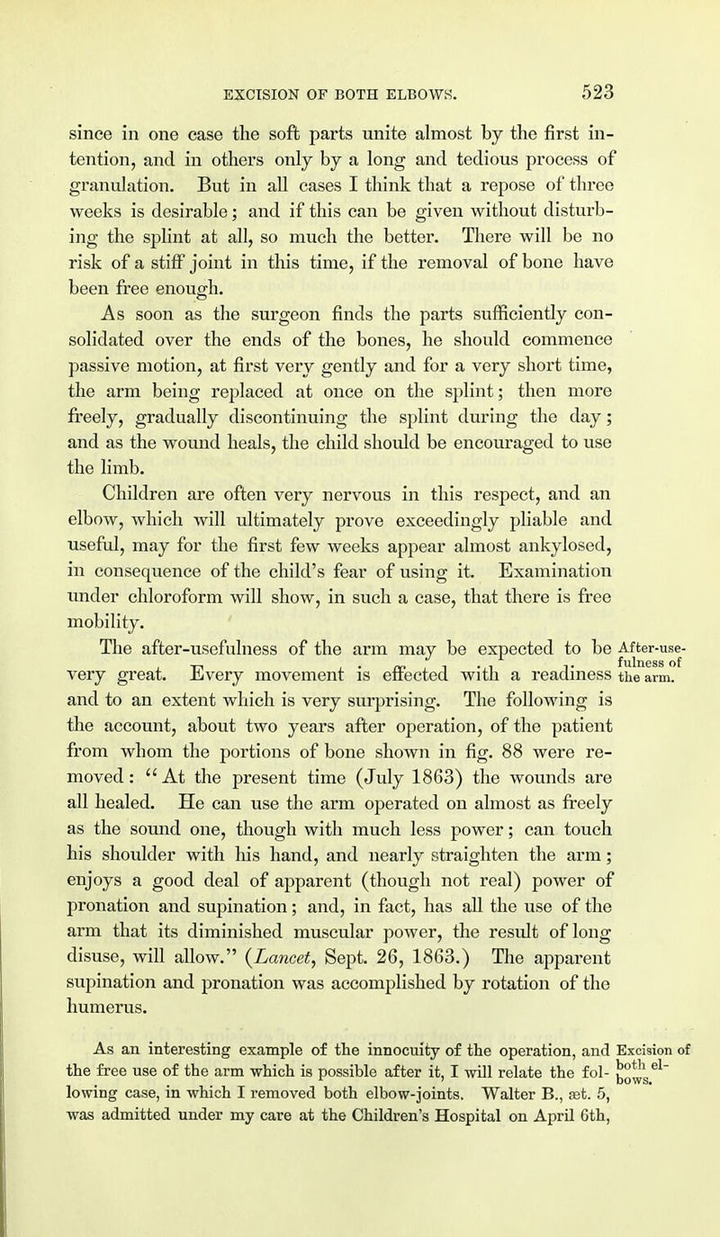 since in one case the soft parts unite almost by the first in- tention, and in others only by a long and tedious process of granulation. But in all cases I think that a repose of three weeks is desirable; and if this can be given without disturb- ing the splint at all, so much the better. There will be no risk of a stiff joint in this time, if the removal of bone have been free enough. As soon as the surgeon finds the parts sufficiently con- solidated over the ends of the bones, he should commence passive motion, at first very gently and for a very short time, the arm being replaced at once on the splint; then more freely, gradually discontinuing the splint during the day; and as the wound heals, the child should be encouraged to use the limb. Children are often very nervous in this respect, and an elbow, Avhich will ultimately prove exceedingly pliable and useful, may for the first few weeks appear almost ankylosed, in consequence of the child's fear of using it. Examination under chloroform will show, in such a case, that there is free mobility. The after-usefulness of the arm may be expected to be After-use- very great. Every movement is effected with a readiness the arm. and to an extent which is very surprising. The following is the account, about two years after operation, of the patient from whom the portions of bone shown in fig. 88 were re- moved: At the present time (July 1863) the wounds are all healed. He can use the arm operated on almost as freely as the sound one, though with much less power; can touch his shoulder with his hand, and nearly straighten the arm; enjoys a good deal of apparent (though not real) power of pronation and supination; and, in fact, has all the use of the arm that its diminished muscular power, the result of long disuse, will allow. {Lancet, Sept. 26, 1863.) The apparent supination and pronation was accomplished by rotation of the humerus. As an interesting example of the innocuity of the operation, and Excision of the free use of the arm which is possible after it, I will relate the fol- {^J1 el~ lowing case, in which I removed both elbow-joints. Walter B., set. 5, was admitted under my care at the Children's Hospital on April 6th,