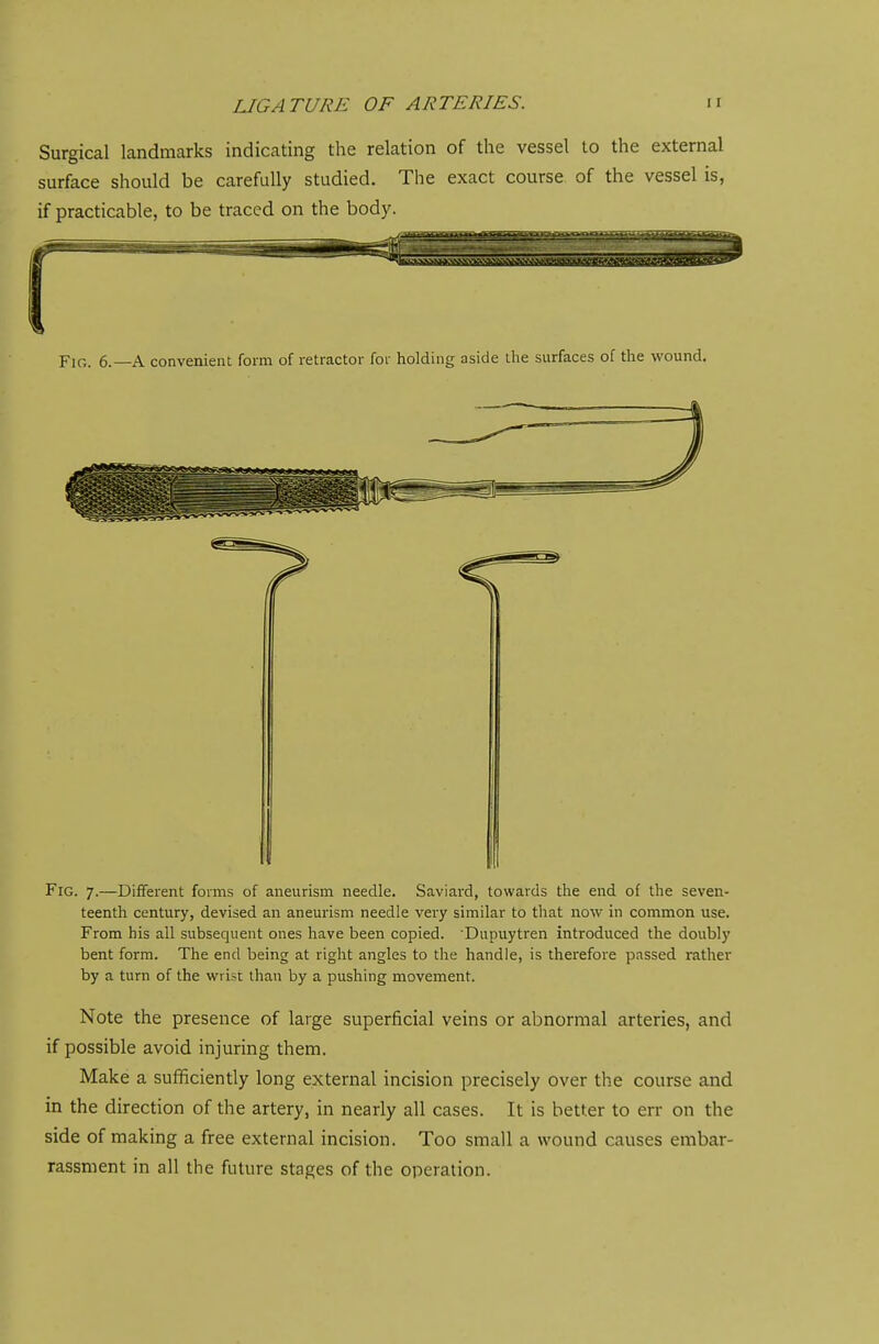 Surgical landmarks indicating the relation of the vessel to the external surface should be carefully studied. The exact course of the vessel is, if practicable, to be traced on the body. Fig. 7.—Different forms of aneurism needle. Saviai-d, towards the end of the seven- teenth century, devised an aneurism needle very similar to that now in common use. From his all subsequent ones have been copied. Dupuytren introduced the doubly bent form. The end being at right angles to the handle, is therefore passed rather by a turn of the wri>t than by a pushing movement. Note the presence of large superficial veins or abnormal arteries, and if possible avoid injuring them. Make a sufficiently long external incision precisely over the course and in the direction of the artery, in nearly all cases. It is better to err on the side of making a free external incision. Too small a wound causes embar- rassment in all the future stages of the operation.