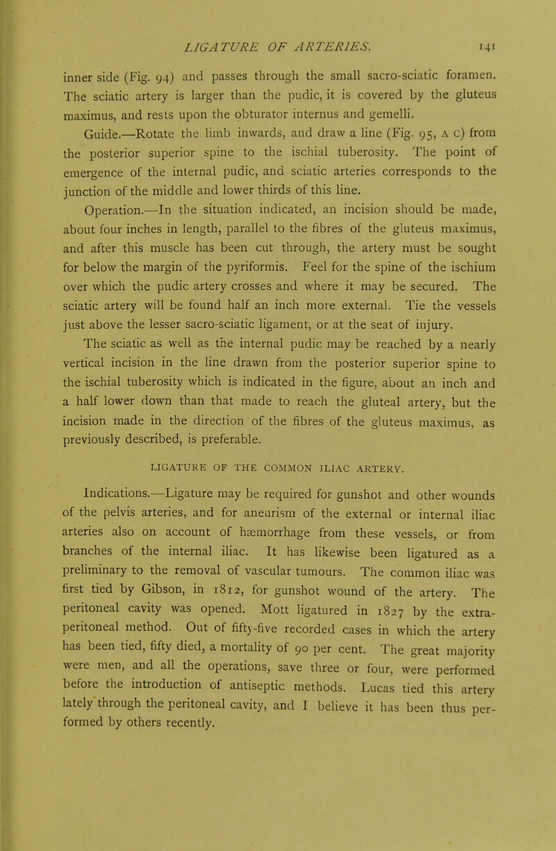 inner side (Fig. 94) and passes through the small sacro-sciatic foramen. The sciatic artery is larger than the pudic, it is covered by the gluteus maximus, and rests upon the obturator interims and gemelli. Guide.—Rotate the limb inwards, and draw a line (Fig. 95, a c) from the posterior superior spine to the ischial tuberosity. The point of emergence of the internal pudic, and sciatic arteries corresponds to the junction of the middle and lower thirds of this line. Operation.—In the situation indicated, an incision should be made, about four inches in length, parallel to the fibres of the gluteus maximus, and after this muscle has been cut through, the artery must be sought for below the margin of the pyriformis. Feel for the spine of the ischium over which the pudic artery crosses and where it may be secured. The sciatic artery will be found half an inch more external. Tie the vessels just above the lesser sacro-sciatic ligament, or at the seat of injury. The sciatic as well as the internal pudic may be reached by a nearly vertical incision in the line drawn from the posterior superior spine to the ischial tuberosity which is indicated in the figure, about an inch and a half lower down than that made to reach the gluteal artery, but the incision made in the direction of the fibres of the gluteus maximus, as previously described, is preferable. LIGATURE OF THE COMMON ILIAC ARTERY. Indications.—Ligature may be required for gunshot and other wounds of the pelvis arteries, and for aneurism of the external or internal iliac arteries also on account of haemorrhage from these vessels, or from branches of the internal iliac. It has likewise been ligatured as a preliminary to the removal of vascular tumours. The common iliac was first tied by Gibson, in 1812, for gunshot wound of the artery. The peritoneal cavity was opened. Mott ligatured in 1827 by the extra- peritoneal method. Out of fifty-five recorded cases in which the artery has been tied, fifty died, a mortality of 90 per cent. The great majority were men, and all the operations, save three or four, were performed before the introduction of antiseptic methods. Lucas tied this artery lately through the peritoneal cavity, and I believe it has been thus per- formed by others recently.