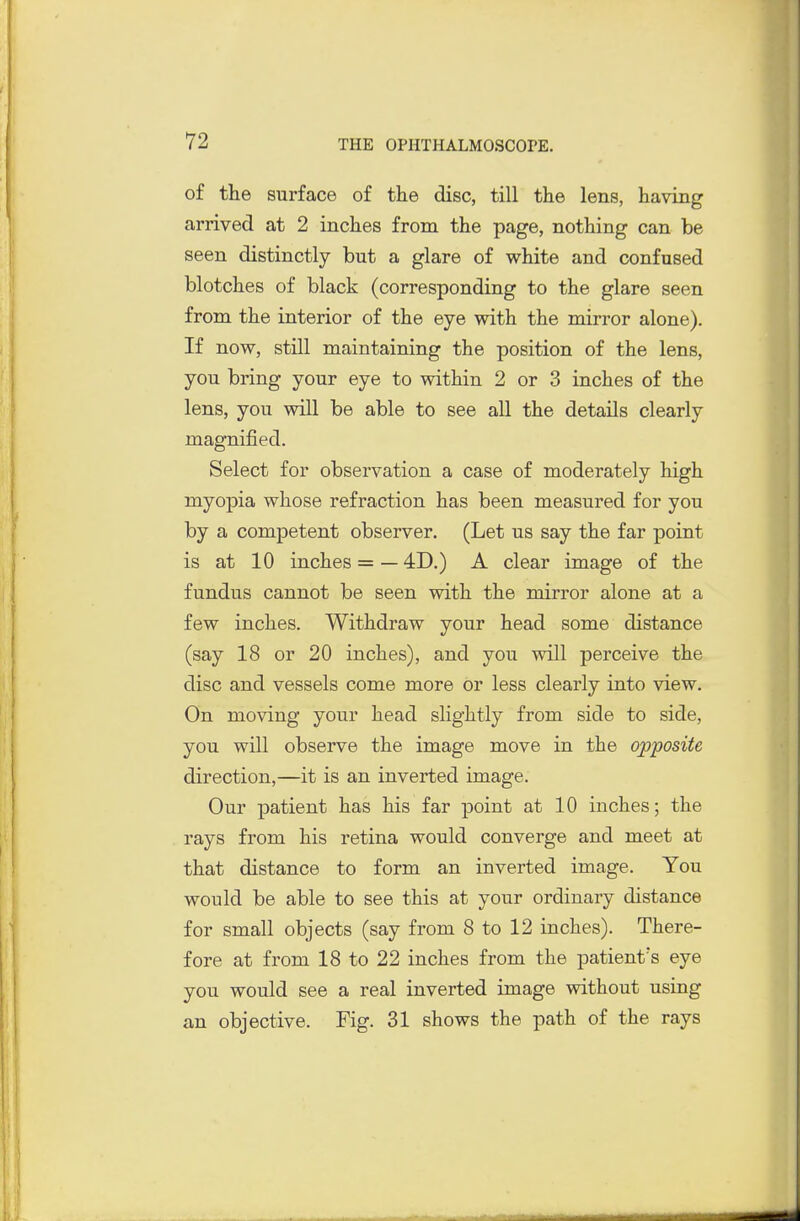 of the surface of the disc, till the lens, having arrived at 2 inches from the page, nothing can be seen distinctly but a glare of white and confused blotches of black (corresponding to the glare seen from the interior of the eye with the mirror alone). If now, still maintaining the position of the lens, you bring your eye to within 2 or 3 inches of the lens, you will be able to see all the details clearly magnified. Select for observation a case of moderately high myopia whose refraction has been measured for you by a competent observer. (Let us say the far point is at 10 inches = — 4D.) A clear image of the fundus cannot be seen with the mirror alone at a few inches. Withdraw your head some distance (say 18 or 20 inches), and you will perceive the disc and vessels come more or less clearly into view. On moving your head slightly from side to side, you will observe the image move in the opposite direction,—it is an inverted image. Our patient has his far point at 10 inches; the rays from his retina would converge and meet at that distance to form an inverted image. You would be able to see this at your ordinary distance for small objects (say from 8 to 12 inches). There- fore at from 18 to 22 inches from the patient's eye you would see a real inverted image without using an objective. Fig. 31 shows the path of the rays