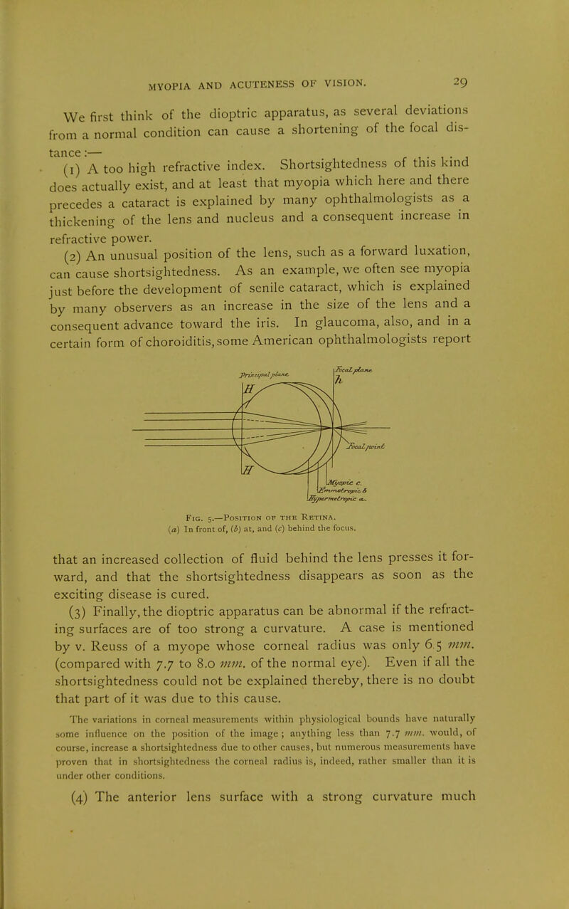 We first think of the dioptric apparatus, as several deviations from a normal condition can cause a shortening of the focal dis- (1) A too high refractive index. Shortsightedness of this kind does actually exist, and at least that myopia which here and there precedes a cataract is explained by many ophthalmologists as a thickening of the lens and nucleus and a consequent increase in refractive power. (2) An unusual position of the lens, such as a forward luxation, can cause shortsightedness. As an example, we often see myopia just before the development of senile cataract, which is explained by many observers as an increase in the size of the lens and a consequent advance toward the iris. In glaucoma, also, and in a certain form of choroiditis, some American ophthalmologists report Fig. 5.—Position of the Retina. (a) In front of, (b) at, and {c) behind the focus. that an increased collection of fluid behind the lens presses it for- ward, and that the shortsightedness disappears as soon as the exciting disease is cured. (3) Finally, the dioptric apparatus can be abnormal if the refract- ing surfaces are of too strong a curvature. A case is mentioned by v. Reuss of a myope whose corneal radius was only 6.5 mm. (compared with 7.7 to 8.0 mm. of the normal eye). Even if all the shortsightedness could not be explained thereby, there is no doubt that part of it was due to this cause. The variations in corneal measurements within physiological bounds have naturally some influence on the position of the image ; anything less than 7.7 vim. would, of course, increase a shortsightedness due to other causes, but numerous measurements have proven that in shortsightedness the corneal radius is, indeed, rather smaller than it is under other conditions. (4) The anterior lens surface with a strong curvature much