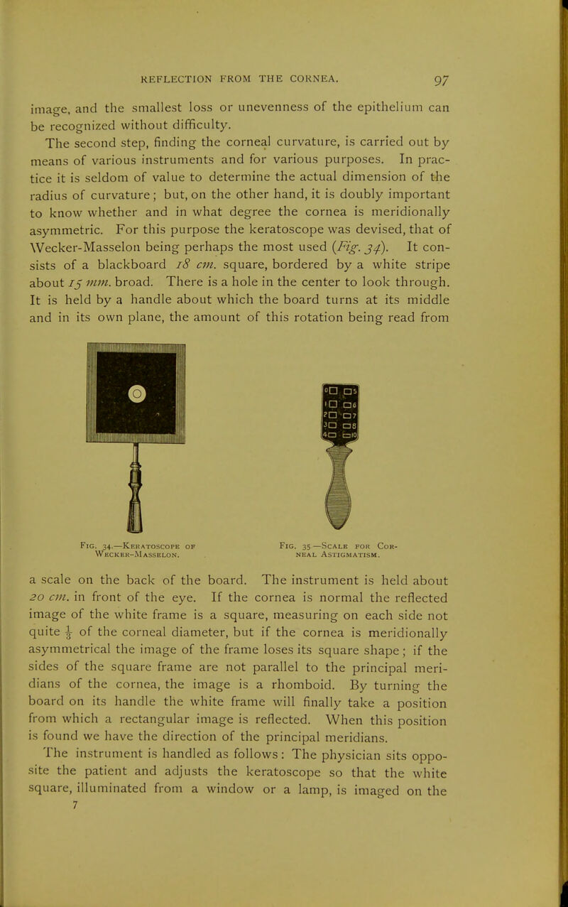 imae-e. and the smallest loss or unevenness of the epithelium can be recognized without difificulty. The second step, finding the corneal curvature, is carried out by- means of various instruments and for various purposes. In prac- tice it is seldom of value to determine the actual dimension of the radius of curvature; but, on the other hand, it is doubly important to know whether and in what degree the cornea is meridionally asymmetric. For this purpose the keratoscope was devised, that of Wecker-Masselon being perhaps the most used {Fig. j^). It con- sists of a blackboard i8 cm. square, bordered by a white stripe about 75 mm. broad. There is a hole in the center to look through. It is held by a handle about which the board turns at its middle and in its own plane, the amount of this rotation being read from Fig. 34.—Keratoscope of Fig. 35 —Scale for Cor- Wecker-Masselon. neal Astigmatism. a scale on the back of the board. The instrument is held about 20 an. in front of the eye. If the cornea is normal the reflected image of the white frame is a square, measuring on each side not quite |- of the corneal diameter, but if the cornea is meridionally asymmetrical the image of the frame loses its square shape; if the sides of the square frame are not parallel to the principal meri- dians of the cornea, the image is a rhomboid. By turning the board on its handle the white frame will finally take a position from which a rectangular image is reflected. When this position is found we have the direction of the principal meridians. The instrument is handled as follows: The physician sits oppo- site the patient and adjusts the keratoscope so that the white square, illuminated from a window or a lamp, is imaged on the 7