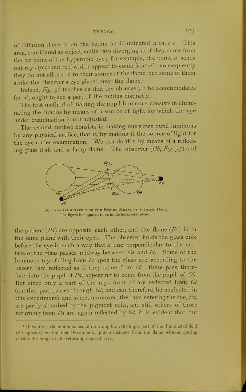 of diffusion there is on the retina an illuminated area, c c. This area, considered as object, emits rays diverging as if they came from the far point of the hyperopic eye; for example, the point,«, sends out rays (marked red) which appear to come from a': consequently they do not all return to their source at the flame, but some of them strike the observer's eye placed near the flame.^ Indeed, Fig. 36 teaches us that the observer, if he accommodates for a', ought to see a part of the fundus distinctly. The first method of making the pupil luminous consists in illumi- nating the fundus by means of a source of light for which the eye under examination is not adjusted. The second method consists in making one's own pupil luminous by any physical artifice, that is, by making it the source of light for the eye under examination. We can do this by means of a reflect- ing glass disk and a lamp flame. The observer {Ob, Fig. jy) and Fig. 37.—Illumination of thk Eye by Means of a Glass Disk. The figure is supposed to be in the horizontal plane. the patient {Pa) are opposite each other, and the flame {Fl) is in the same plane with their eyes. The observer holds the glass disk before the eye in such a way that a line perpendicular to the sur- face of the glass passes midway between Pa and Fl. Some of the luminous fays falling from Fl upon the glass are, according to the known law, reflected as if they came from Fl'; these pass, there- fore, into the pupil of Pa, appearing to come from the pupil of Ob. But since only a part of the rays from Fl are reflected from Gl (another part passes through Gl, and can, therefore, be neglected in this experiment), and since, moreover, the rays entering the eye, are partly absorbed by the pigment cells, and still others of those returning from Pa are again reflected by Gl, it is evident that but 1 If we trace the luminous pencil returning from the upper part of the illuminated field (the upper c), we find that Ob can be at quite a di.stance from the flame without; getting outside the range of the returning cone of rays.