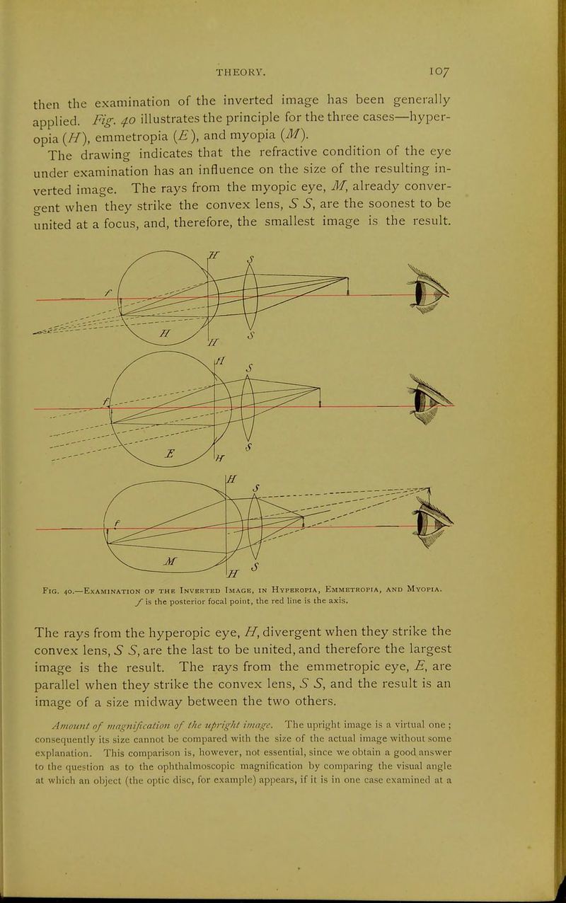 then the examination of the inverted image has been generally applied. Fig. 40 illustrates the principle for the three cases—hyper- opia {H), emmetropia {£), and myopia {M). The drawing indicates that the refractive condition of the eye under examination has an influence on the size of the resulting in- verted image. The rays from the myopic eye, M, already conver- gent when they strike the convex lens, S S, are the soonest to be united at a focus, and, therefore, the smallest image is the result. Fig. 40.—Examination of the Inverted Image, in Hyperopia, Emmetropia, and Myopia. y is the posterior focal point, the red line is the axis. The rays from the hyperopic eye, //, divergent when they strike the convex lens, 5 S, are the last to be united, and therefore the largest image is the result. The rays from the emmetropic eye, E, are parallel when they strike the convex lens, 5 S, and the result is an image of a size midway between the two others. Amotint of magnification of the upright image. The upright image is a virtual one ; consequently its size cannot be compared with the size of the actual image without some explanation. This comparison is, however, not essential, since we obtain a good answer to the question as to the ophthalmoscopic magnification by comparing the visual angle at wiiich an object (the optic disc, for example) appears, if it is in one case examined at a
