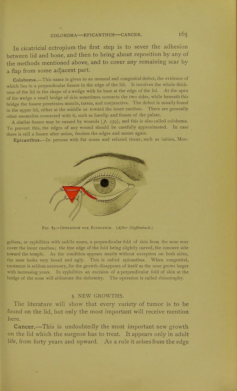 COLOBOMA—EPICANTHUS—CANCER. In cicatricial ectropium the first step is to sever the adhesion between lid and bone, and then to bring about reposition by any of the methods mentioned above, and to cover any remaining scar by a flap from some adjacent part. Coloboma. This name is given to an unusual and congenital defect, the evidence of which lies in a perpendicular fissure in the edge of the lid. It involves the whole thick- ness of the lid in the shape of a wedge with its base at the edge of the lid. At the apex of the wedge a small bridge of skin sometimes connects the two sides, while beneath this bridge the fissure penetrates muscle, tarsus, and conjunctiva. The defect is usually found in the upper lid, either at the middle or toward the inner canthus. There are generally other anomalies connected with it, such as harelip and fissure of the palate. A similar fissure may be caused by wounds {p. i^g), and this is also called coloboma. To prevent this, the edges of any wound should be carefully approximated. In case there is still a fissure after union, freshen the edges and suture again. Epicanthus.—In persons with flat noses and relaxed tissue, such as babies, Mon- FiG. 63.—Operation for Ectropium. (After Dieffenbach.) golians, or syphilitics with saddle noses, a perpendicular fold of skin from the nose may cover the inner canthus; the free edge of the fold being slightly curved, the concave side toward the temple. As the condition appears nearly without exception on both sides, the nose looks very broad and ugly. This is called epicanthus. When congenital, treatment is seldom necessary, for the growth disappears of itself as the nose grows larger with increasing years. In syphilitics an excision of a perpendicular fold of skin at the bridge of the nose will obliterate the deformity. The operation is called rhinorraphy. 5. NEW GROWTHS. The literature will show that every variety of tumor is to be found on the lid, but only the most important will receive mention here. Cancer.—This is undoubtedly the most important new growth on the lid which the surgeon has to treat. It appears only in adult life, from forty years and upward. As a rule it arises from the edge