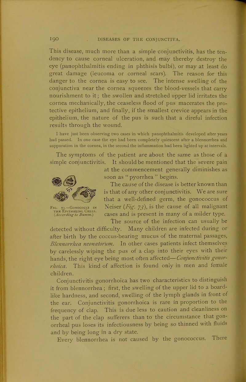 This disease, much more than a simple conjunctivitis, has the ten- dency to cause corneal ulceration, and may thereby destroy the eye (panophthalmitis ending in phthisis bulbi), or may at least do great damage (leucoma or corneal scars). The reason for this danger to the cornea is easy to see. The intense swelling of the conjunctiva near the cornea squeezes the blood-vessels that carry nourishment to it; the swollen and stretched upper lid irritates the cornea mechanically, the ceaseless flood of pus macerates the pro- tective epithelium, and finally, if the smallest crevice appears in the epithelium, the nature of the pus is such that a direful infection results through the wound. I have just been observing two cases in which panophthalmitis developed after years had passed. In one case the eye had been completely quiescent after a blennorrhea and suppuration in the cornea, in the second the inflammation had been lighted up at intervals. The symptoms of the patient are about the same as those of a simple conjunctivitis. It should be mentioned that the severe pain at the commencement generally diminishes as soon as pyorrhea begins. The cause of the disease is better known than is that of any other conjunctivitis. We are sure that a well-defined germ, the gonococcus of Fig. 73.-G0NOCOCC1 IN Neiser {Fig. yj), is the cause of all malignant THE Epithelial Cells. , . . - -i j ^ {Accordingto Bumtti.) cases and IS present m many 01 a milder type. The source of the infection can usually be detected without difficulty. Many children are infected during or after birth by the coccus-bearing mucus of the maternal passages, Blennorrhea neonatorum. In other cases patients infect themselves by carelessly wiping the pus of a clap into their eyes with their hands, the right eye being most often affected—Conjunctivitis gonor- rhoica. This kind of affection is found only in men and female children. Conjunctivitis gonorrhoica has two characteristics to distinguish it from blennorrhea ; first, the swelling of the upper lid to a board- like hardness, and second, swelling of the lymph glands in front of the ear. Conjunctivitis gonorrhoica is rare in proportion to the frequency of clap. This is due less to caution and cleanliness on the part of the clap sufferers than to the circumstance that gon- orrheal pus loses its infectiousness by being so thinned with fluids and by being long in a dry state. Every blennorrhea is not caused by the gonococcus. There