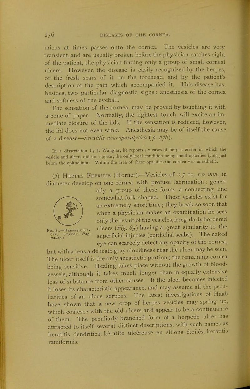 micLis at times passes onto the cornea. The vesicles are very transient, and are usually broken before the physician catches sight of the patient, the physician finding only a group of small corneal ulcers. However, the disease is easily recognized by the herpes, or the fresh scars of it on the forehead, and by the patient's description of the pain which accompanied it. This disease has, besides, two particular diagnostic signs: anesthesia of the cornea and softness of the eyeball. The sensation of the cornea may be proved by touching it with a cone of paper. Normally, the lightest touch will excite an im- mediate closure of the lids. If the sensation is reduced, however, the lid does not even wink. Anesthesia may be of itself the cause of a disease—keratitis neiiroparalytica {p. 2j8). In a dissertation by J. Wanglar, he reports six cases of herpes zoster in which the vesicle and ulcers did not appear, the only local condition being small opacities lying just below the epithelium. Within the area of these opacities the cornea was anesthetic. (/?) Herpes Febrilis (Horner).—Vesicles of 0.5 to i.o mm. in diameter develop on one cornea with profuse lacrimation ; gener- ally a group of these forms a connecting line somewhat fork-shaped. These vesicles exist for an extremely short time; they break so soon that when a physician makes an examination he sees only the result of the vesicles, irregularly bordered F:a.85.-H.BPBT.cUL- ulcers {Fig. 8^) having a great similarity to the ««Lr./^^'^'' superficial injuries (epithelial scabs). The naked eye can. scarcely detect any opacity of the cornea, but with a lens a delicate gray cloudiness near the ulcer may be seen. The ulcer itself is the only anesthetic portion ; the remaining cornea being sensitive. Healing takes place without the growth of blood- vessels, although it takes much longer than in equally extensive loss of substance from other causes. If the ulcer becomes infected it loses its characteristic appearance, and may assume all the pecu- liarities of an ulcus serpens. The latest investigations of Haab have shown that a new crop of herpes vesicles may spring up, which coalesce with the old ulcers and appear to be a continuance of them. The peculiarly branched form of a herpetic ulcer has attracted to itself several distinct descriptions, with such names as keratitis dendritica, keratite ulcereuse en sillons etoiles, keratitis ramiformis.