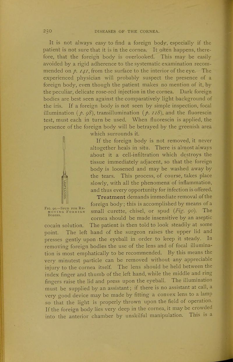 It is not always easy to find a foreign body, especially if the patient is not sure that it is in the cornea. It often happens, there- fore, that the foreign body is overlooked. This may be easily avoided by a rigid adherence to the systematic examination recom- mended on p. i^i, from the surface to the interior of the eye. The experienced physician will probably suspect the presence of a foreign body, even though the patient makes no mention of it, by the peculiar, delicate rose-red injection in the cornea. Dark foreign bodies are best seen against the comparatively light background of the iris. If a foreign body is not seen by simple inspection, focal illumination [p. p8), transillumination {p. ii8), and the fluorescin test, must each in turn be used. When fluorescin is applied, the presence of the foreign body will be betrayed by the greenish area which surrounds it. I If the foreign body is not removed, it never altogether heals in situ. There is almost always about it a cell-infiltration which destroys the tissue immediately adjacent, so that the foreign body is loosened and may be washed away by the tears. This process, of course, takes place slowly, with all the phenomena of inflammation, and thus every opportunity for infection is offered. Treatment demands immediate removal of the foreign body; this is accomplished by means of a Fig. go.—Spud for Re- i • i 1/7-^- \ Tu MOVING Foreign Small curcttc, chiscl, or spud [rig: go), ine cornea should be made insensitive by an aseptic Cocain solution. The patient is then told to look steadily at some point. The left hand of the surgeon raises the upper lid and presses gently upon the eyeball in order to keep it steady. In removine foreign bodies the use of the lens and of focal illumina- tion is most emphatically to be recommended. By this means the very minutest particle can be removed without any appreciable injury to the cornea itself The lens should be held between the index finger and thumb of the left hand, while the middle and ring fingers raise the lid and press upon the eyeball. The illumination must be supplied by an assistant; if there is no assistant at call, a very good device may be made by fitting a convex lens to a lamp so that the light is properly thrown upon the field of operation. If the foreign body lies very deep in the cornea, it may be crowded into the anterior chamber by unskilful manipulation. This is a