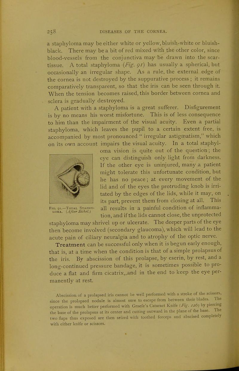 a Staphyloma may be either white or yellow, bluish-white or bluish- black. There may be a bit of red mixed with the other color, since blood-vessels from the conjunctiva may be drawn into the scar- tissue. A total staphyloma {Fig. pi) has usually a spherical, but occasionally an irregular shape. As a rule, the external edge of the cornea is not destroyed by the suppurative process ; it remains comparatively transparent, so that the iris can be seen through it. When the tension becomes raised, this border between cornea and sclera is gradually destroyed. A patient with a staphyloma is a great sufferer. Disfigurement is by no means his worst misfortune. This is of less consequence to him than the impairment of the visual acuity. Even a partial staphyloma, which leaves the pupil to a certain extent free, is accompanied by most pronounced  irregular astigmatism, which on its own account impairs the visual acuity. In a total staphyl- oma vision is quite out of the question; the eye can distinguish only light from darkness. If the other eye is uninjured, many a patient micfht tolerate this unfortunate condition, but he has no peace; at every movement of the lid and of the eyes the protruding knob is irri- tated by the edges of the lids, while it may, on its part, prevent them from closing at all. This Fig. 91.-T0TAL staphy- all rcsults in a painful condition of inflamma- LOMA. {After Sichel.) ^ . tion, and if the lids cannot close, the unprotected staphyloma may shrivel up or ulcerate. The deeper parts of the eye then become involved (secondary glaucoma), which will lead to the acute pain of ciliary neuralgia and to atrophy of the optic nerve. Treatment can be successful only when it is begun early enough, that is, at a time when the condition is that of a simple prolapsus of the iris. By abscission of this prolapse, by eserin, by rest, and a long-continued pressure bandage, it is sometimes possible to pro- duce a flat and firm cicatrix,.and in the end to keep the eye per- manently at rest. Abscission of a prolapsed iris cannot be well performed with a stroke of the scissors, since the prolapsed nodule is almost sure to escape from between their blades. 'Hie operation is much better performed with Graefe's Cataract Knife (Fig. 126) by piercing the base of the prolapsus at its center and cutting outward in the plane of the base. 1 he two flaps thus exposed are then seized with toothed forceps and abscised completely with either knife or scissors.