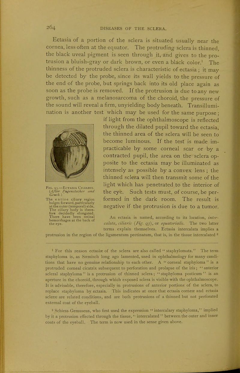 Ectasia of a portion of the sclera is situated usually near the cornea, less often at the equator. The protruding sclera is thinned, the black uveal pigment is seen through it, and gives to the pro- trusion a bluish-gray or dark brown, or even a black color.' The thinness of the protruded sclera is characteristic of ectasia ; it may be detected by the probe, since its wall yields to the pressure of the end of the probe, but springs back into its old place again as soon as the probe is removed. If the protrusion is due to any new growth, such as a melanosarcoma of the choroid, the pressure of the sound will reveal a firm, unyielding body beneath. Transillumi- nation is another test which may be used for the same purpose; if light from the ophthalmoscope is reflected through the dilated pupil toward the ectasia, the thinned area of the sclera will be seen to become luminous. If the test is made im- practicable by some corneal scar or by a contracted pupil, the area on the sclera op- posite to the ectasia may be illuminated as intensely as possible by a convex lens ; the thinned sclera will then transmit some of the light which has penetrated to the interior of the eye. Such tests must, of course, be per- formed in the dark room. The result is negative if the protrusion is due to a tumor. An ectasia is named, according to its location, iiiier- calaia, ciliaris {Fig. gj), or equatorialis. The two latter terms explain themselves. Ectasia intercalata implies a protrusion in the region of the ligamentum pectinatum, that is, in the tissue intercalated ^ ^ For this reason ectasiee of the sclera are also called  staphylomata. The term staphyloma is, as Sremisch long ago lamented, used in ophthalmology for many condi- tions that have no genuine relafionship to each other. A  corneal staphyloma  is a protruded corneal cicatrix subsequent to perforation and prolapse of the iris;  anterior scleral staphyloma is a protrusion of thinned sclera; staphyloma posticum  is an aperture in the choroid, through which exposed sclera is visible with the ophthalmoscope. It is advisable, therefore, especially in protrusions of anterior portions of the sclera, to replace staphyloma by ectasia. This indicates at once that ectasia corneae and ectasia scIerK are related conditions, and are both protrusions of a thinned but not perforated external coat of the eyeball. 2 Schiess-Gemuseus, who first used the expression  intercalary staphyloma, implied by it a protrusion effected through the tissue, '• intercalated  between the outer and inner coats of the eyeball. The term is now used in the sense given above. Fig. g3.—Ectasia Ciliaris. {After Pagenstecher u7id Genth ) ' The entire ciliary region bulges forward, particularly at the outer (temporal) side. The ciliary body is there- fore decidedly elongated. There have been retinal hemorrhages at the back of the eye.