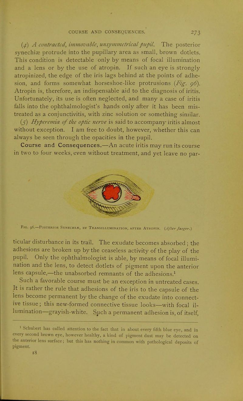 COURSE AND CONSEQUENCES. (^) A contracted, immovable, unsyminctricalpupil. The posterior synechire protrude into the pupillary area as small, brown dotlets. This condition is detectable only by means of focal illumination and a lens or by the use of atropin. If such an eye is strongly atropinized, the edge of the iris lags behind at the points of adhe- sion, and forms somewhat horseshoe-like protrusions {Fig. g6). Atropin is, therefore, an indispensable aid to the diagnosis of iritis. Unfortunately, its use is often neglected, and many a case of iritis falls into the ophthalmologist's h^nds only after it has been mis- treated as a conjunctivitis, with zinc solution or something similar. (5) Hyperemia of the optic nerve is said to accompany iritis almost without exception. I am free to doubt, however, whether this can always be seen through the opacities in the pupil. Course and Consequences.—An acute iritis may run its course in two to four weeks, even without treatment, and yet leave no par- FiG. 96.—Posterior Synechi.e, by Transillumination, after Atropin. {After faeger.) ticular disturbance in its trail. The exudate becomes absorbed ; the adhesions are broken up by the ceaseless activity of the play of the pupil. Only the ophthalmologist is able, by means of focal illumi- nation and the lens, to detect dotlets of pigment upon the anterior lens capsule,—the unabsorbed remnants of the adhesions.^ Such a favorable course must be an exception in untreated cases. It is rather the rule that adhesions of the iris to the capsule of the lens become permanent by the change of the exudate into connect- ive tissue ; this new-formed connective tissue looks—with focal il- lumination—grayish-white. Such a permanent adhesion is, of itself, 1 Schubert has called attention to the fact that in about every fifth blue eye, and in every second brown eye, however healthy, a kind of pigment dust may be delected on the anterior lens surface; but this has nothing in common with pathological deposits of pigment. I8
