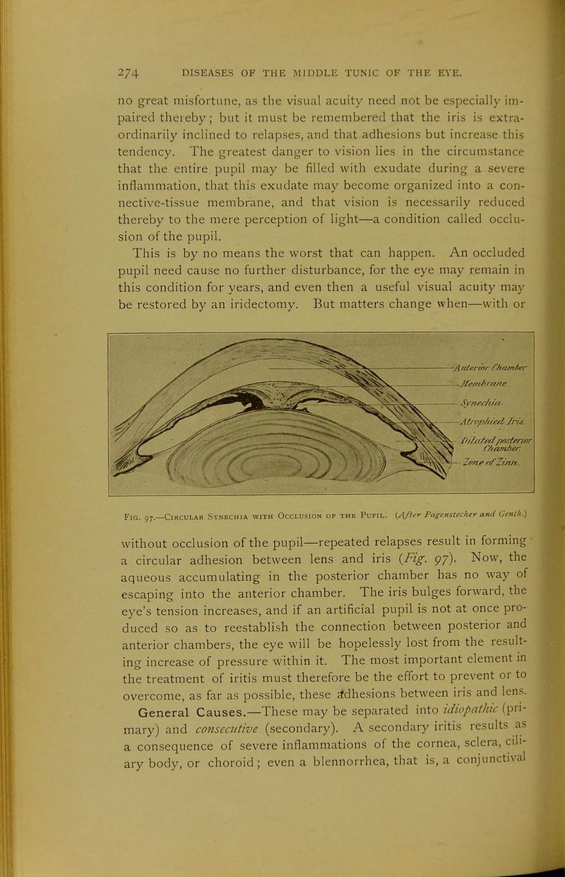 no great misfortune, as the visual acuity need not be especially im- paired thereby; but it must be remembered that the iris is extra- ordinarily inclined to relapses, and that adhesions but increase this tendency. The greatest danger to vision lies in the circumstance that the entire pupil may be filled with exudate during a severe inflammation, that this exudate may become organized into a con- nective-tissue membrane, and that vision is necessarily reduced thereby to the mere perception of light—a condition called occlu- sion of the pupil. This is by no means the worst that can happen. An occluded pupil need cause no further disturbance, for the eye may remain in this condition for years, and even then a useful visual acuity may be restored by an iridectomy. But matters change when—with or —JfefnAretne A trop/iied. Jris. /h/fi/cä//oster/ßr C/teinU/er. - ZtTTie ofZimv. Fig. 97.—Circular Synechia with Occlusion of the Pupil. {After Pagenstecher and Genth.) without occlusion of the pupil—repeated relapses result in forming a circular adhesion between lens and iris {^Fig. gf). Now, the aqueous accumulating in the posterior chamber has no way of escaping into the anterior chamber. The iris bulges forward, the eye's tension increases, and if an artificial pupil is not at once pro- duced so as to reestablish the connection between po.sterior and anterior chambers, the eye will be hopelessly lost from the result- ing increase of pressure within it. The most important element in the treatment of iritis must therefore be the effort to prevent or to overcome, as far as possible, these adhesions between iris and lens. General Causes.—These may be separated into idiopathic (pri- mary) and conseattive (secondary). A secondary iritis results as a consequence of severe inflammations of the cornea, sclera, cili- ary body, or choroid; even a blennorrhea, that is, a conjunctival