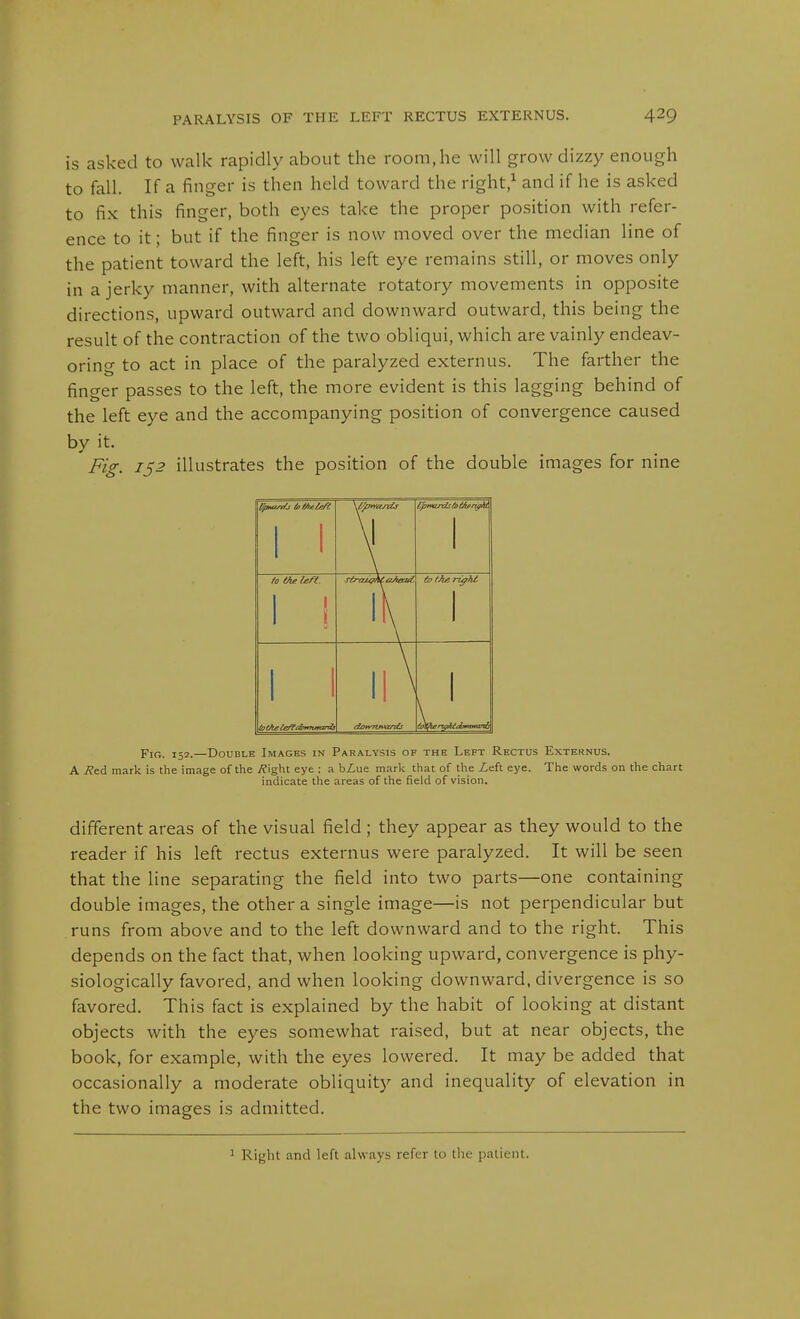 is asked to walk rapidly about the room, he will grow dizzy enough to fall. If a finger is then held toward the right/ and if he is asked to fix this finger, both eyes take the proper position with refer- ence to it; but if the finger is now moved over the median line of the patient toward the left, his left eye remains still, or moves only in a jerky manner, with alternate rotatory movements in opposite directions, upward outward and downward outward, this being the result of the contraction of the two obliqui, which are vainly endeav- oring to act in place of the paralyzed externus. The farther the finger passes to the left, the more evident is this lagging behind of the left eye and the accompanying position of convergence caused by it. Fig. 152 illustrates the position of the double images for nine M 1 t \ I \ 1 1 \ Fig. 152.—Double Images in Paralysis of the Left Rectus Externus. A Äed mark is the image of the j^ight eye ; a bZue mark that of the Xeft eye. The words on the chart indicate the areas of the field of vision. different areas of the visual field ; they appear as they would to the reader if his left rectus externus were paralyzed. It will be seen that the line separating the field into two parts—one containing double images, the other a single image—is not perpendicular but runs from above and to the left downward and to the right. This depends on the fact that, when looking upward, convergence is phy- siologically favored, and when looking downward, divergence is so favored. This fact is explained by the habit of looking at distant objects with the eyes somewhat raised, but at near objects, the book, for example, with the eyes lowered. It may be added that occasionally a moderate obliquity and inequality of elevation in the two images is admitted. 1 Right and left always refer to the patient.