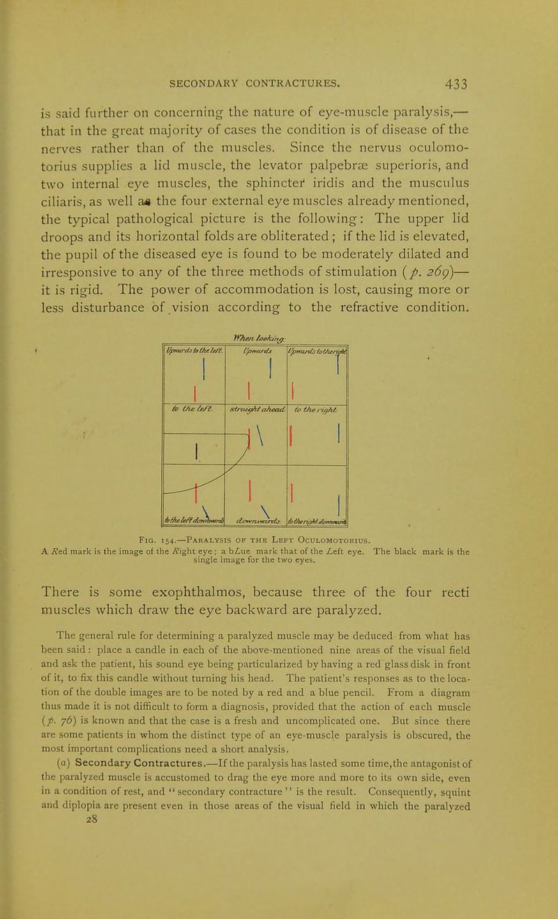 is said further on concerning the nature of eye-muscle paralysis,— that in the great majority of cases the condition is of disease of the nerves rather than of the muscles. Since the nervus oculomo- torius supplies a lid muscle, the levator palpebras superioris, and two internal eye muscles, the sphinctei iridis and the musculus ciliaris, as well ag the four external eye muscles already mentioned, the typical pathological picture is the following: The upper lid droops and its horizontal folds are obliterated ; if the lid is elevated, the pupil of the diseased eye is found to be moderately dilated and irresponsive to any of the three methods of stimulation 26())— it is rigid. The power of accommodation is lost, causing more or less disturbance of vision according to the refractive condition. JVhentook/no: UpKordsbtheU/i. 1 \ 1 üb aiele/-t ^ ahead' \ to theri^ht 1 1 Ja. 1 Fig. 154.—Paralysis of the Left Oculomotorius. A ^ed mark is the image of tlie i?iglit eye ; a bZ,ue mark that of the Le.it eye. The black mark is the single image for the two eyes. There is some exophthalmos, because three of the four recti muscles which draw the eye backward are paralyzed. The general rule for determining a paralyzed muscle may be deduced from what has been said: place a candle in each of the above-mentioned nine areas of the visual field and ask the patient, his sound eye being particularized by having a red glass disk in front of it, to fix this candle without turning his head. The patient's responses as to the loca- tion of the double images are to be noted by a red and a blue pencil. From a diagram thus made it is not difficult to form a diagnosis, provided that the action of each muscle (A 7^) known and that the case is a fresh and uncomplicated one. But since there are some patients in whom the distinct type of an eye-muscle paralysis is obscured, the most important complications need a short analysis. (a) Secondary Contractures.—If the paralysis has lasted some time,the antagonist of the paralyzed muscle is accustomed to drag the eye more and more to its own side, even in a condition of rest, and secondary contracture is the result. Consequently, squint and diplopia are present even in those areas of the visual field in which the paralyzed 28